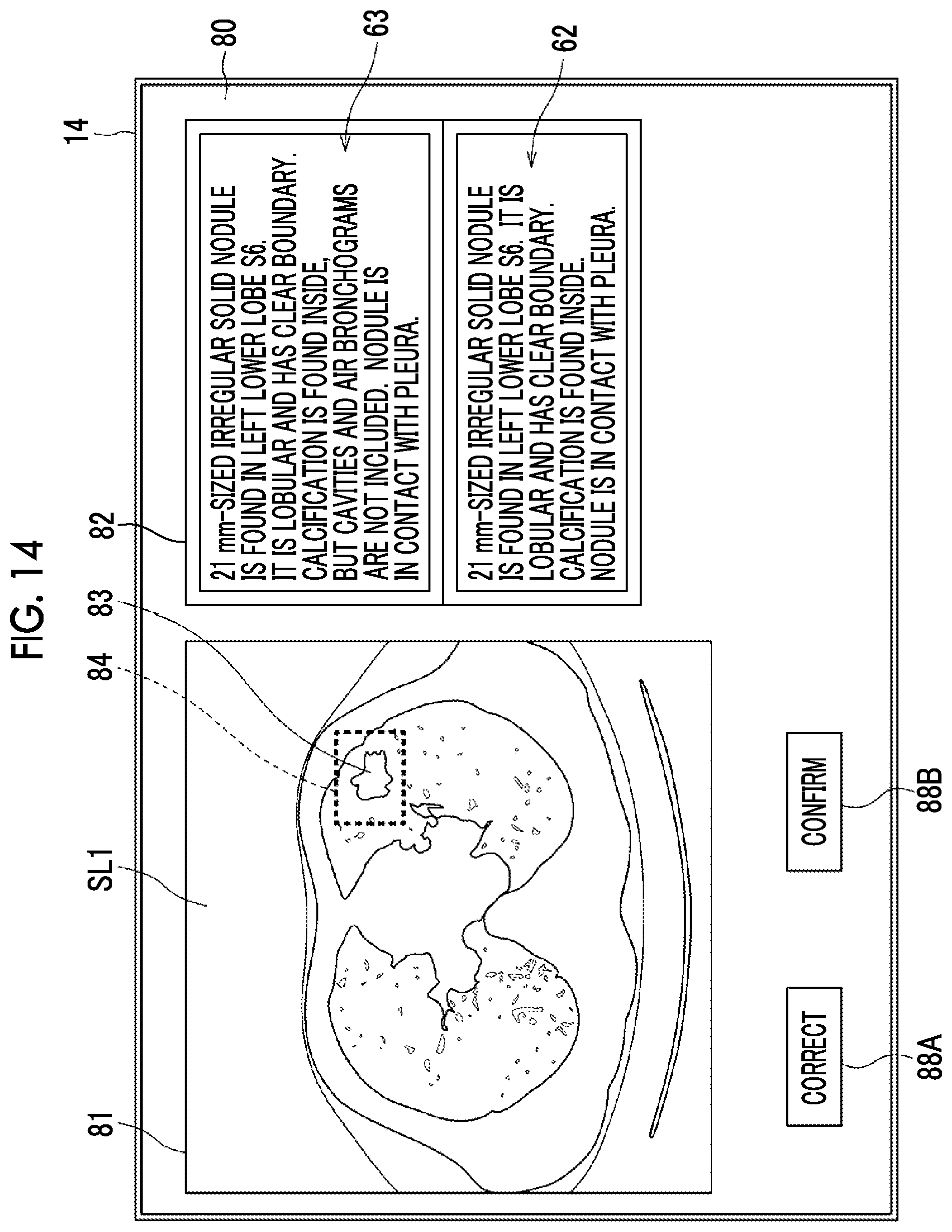 Patent US12417838 Figure 12 – Document creation support apparatus, method, and program to generate medical document based on medical images