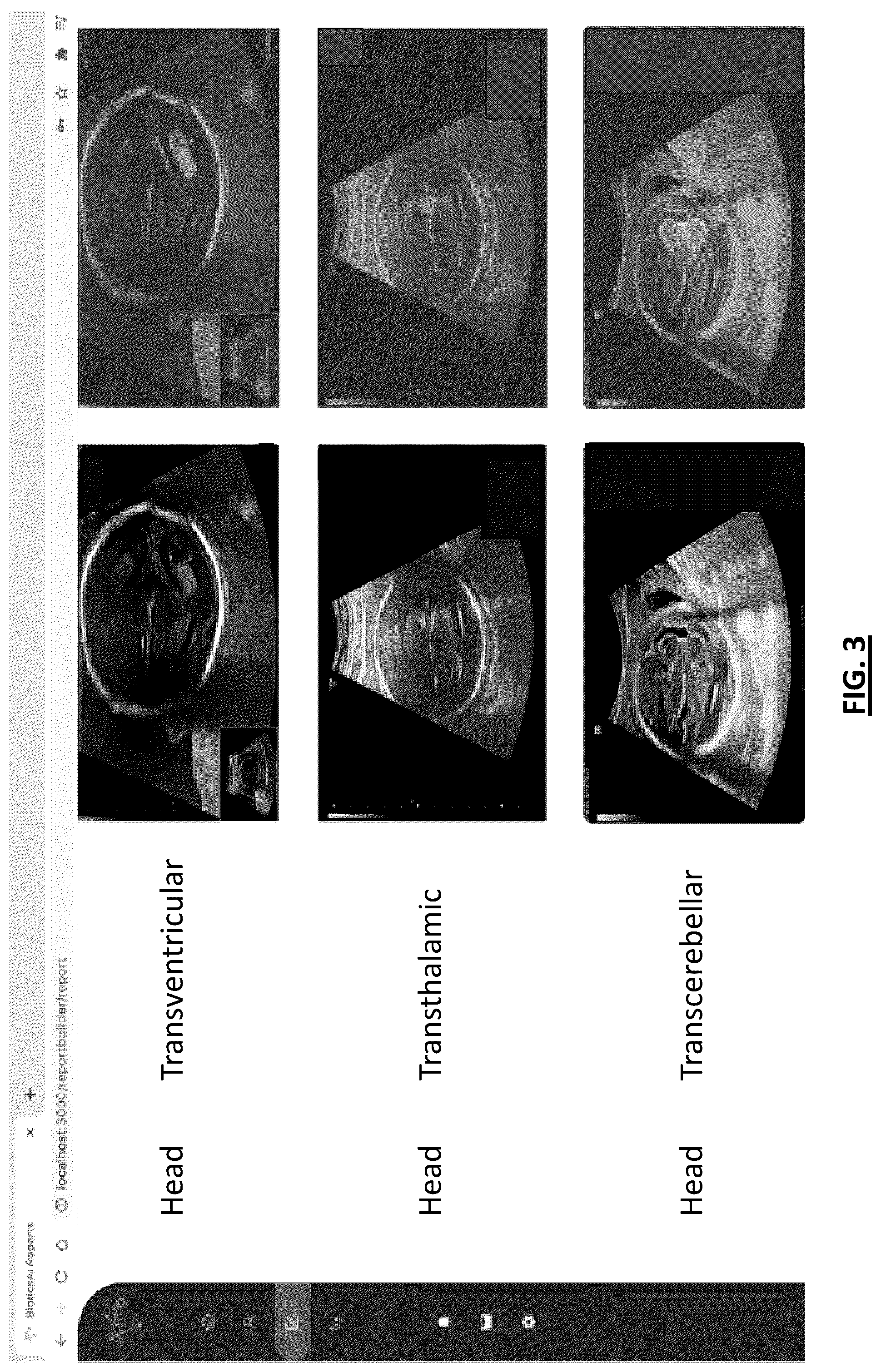Patent US12417845 Figure 4 – System for aggregating, analyzing, and reporting medical information