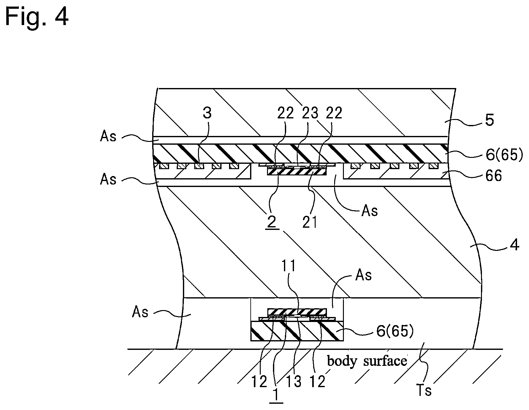 Patent US12422308 Figure 4 – Deep temperature measuring device and deep temperature measuring method