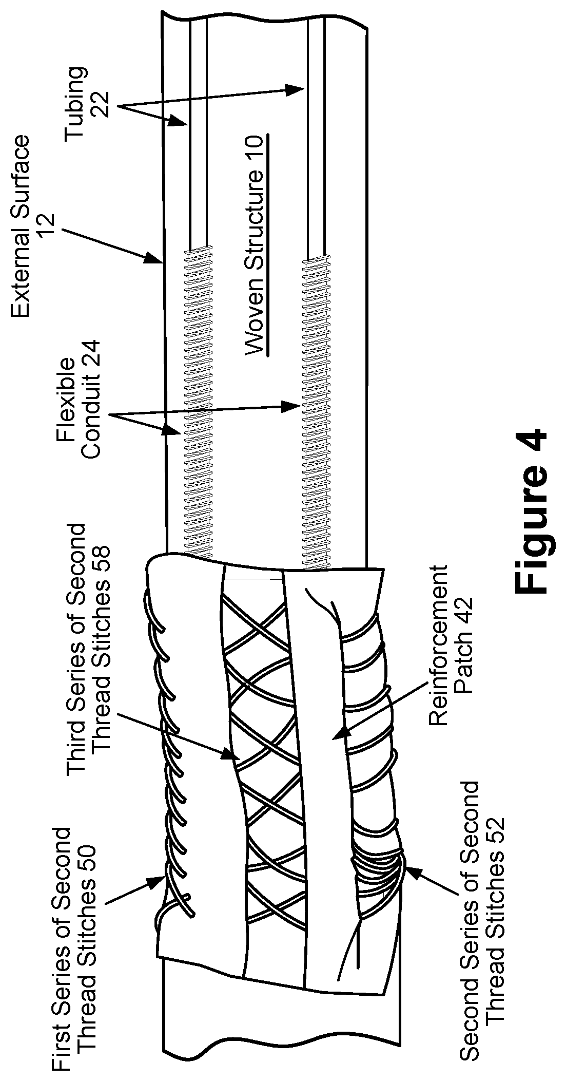 Patent US12422317 Figure 4 – Fiber optic sensor egress/ingress ruggedization for flexible woven structures