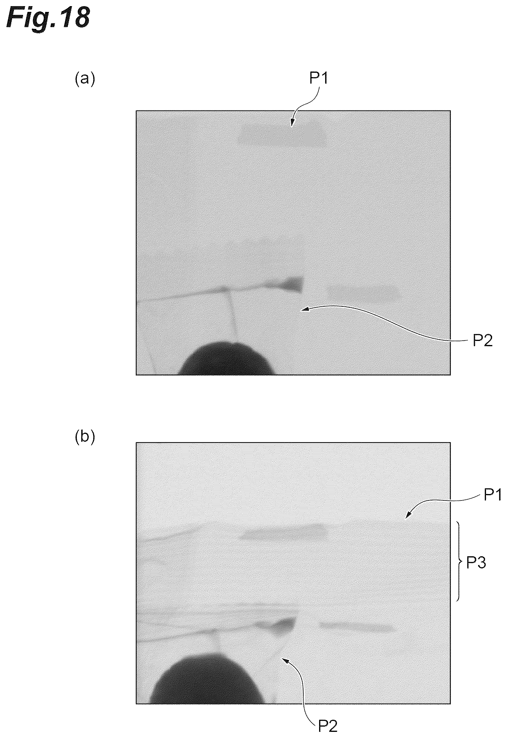 Patent US12422383 Figure 18 – Imaging unit, radiological image acquisition system, and radiological image acquisition method