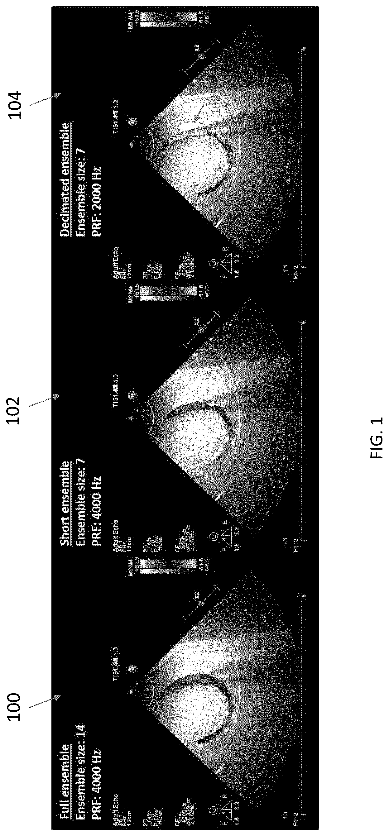 Patent US12422548 — Systems and methods for generating color doppler images from short and undersampled ensembles — Figure 1