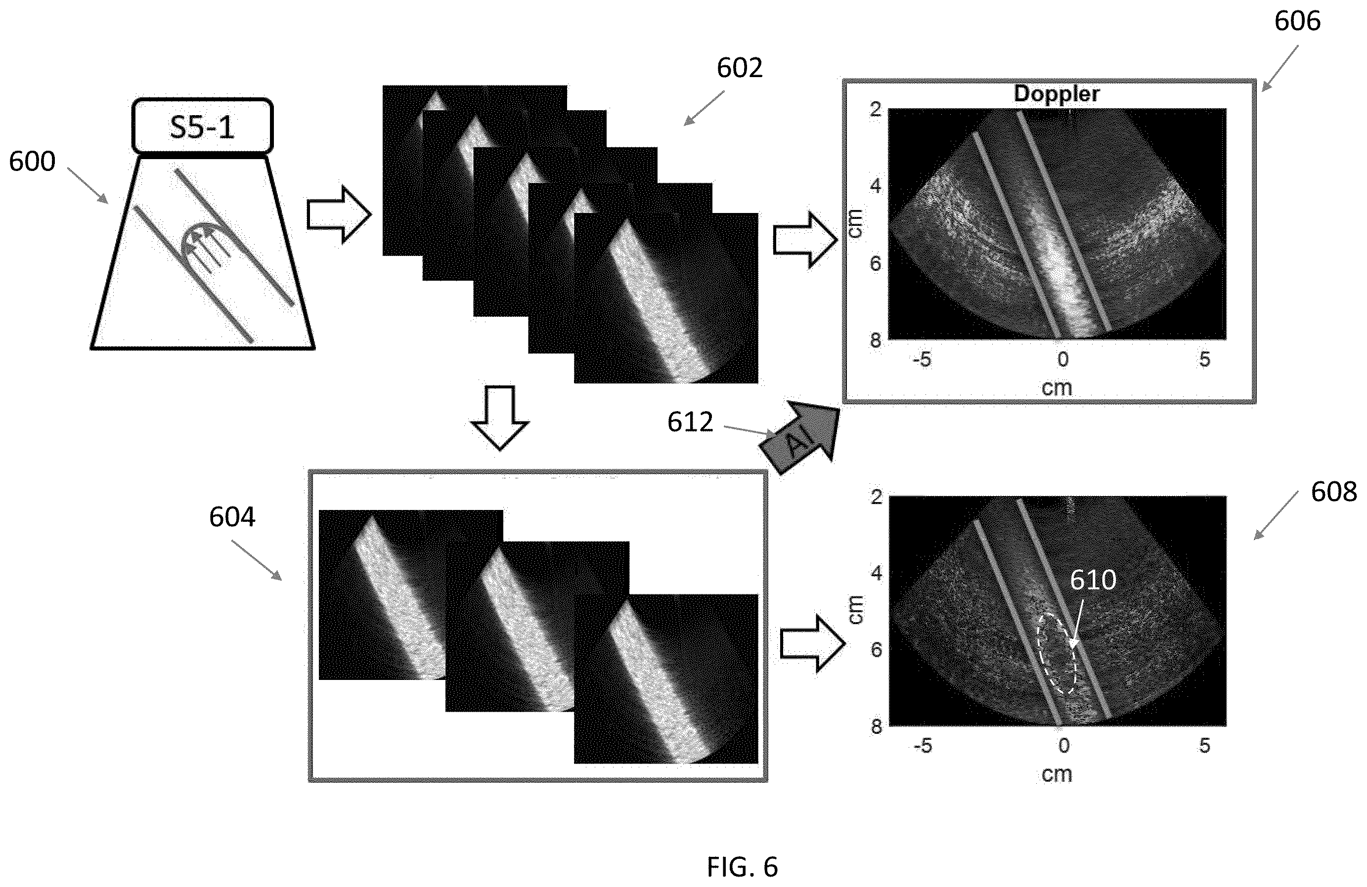 Patent US12422548 Figure 6 – Systems and methods for generating color doppler images from short and undersampled ensembles