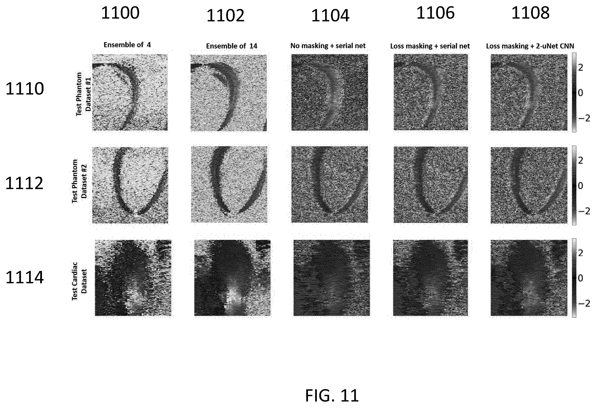Patent US12422548 Figure 11 – Systems and methods for generating color doppler images from short and undersampled ensembles