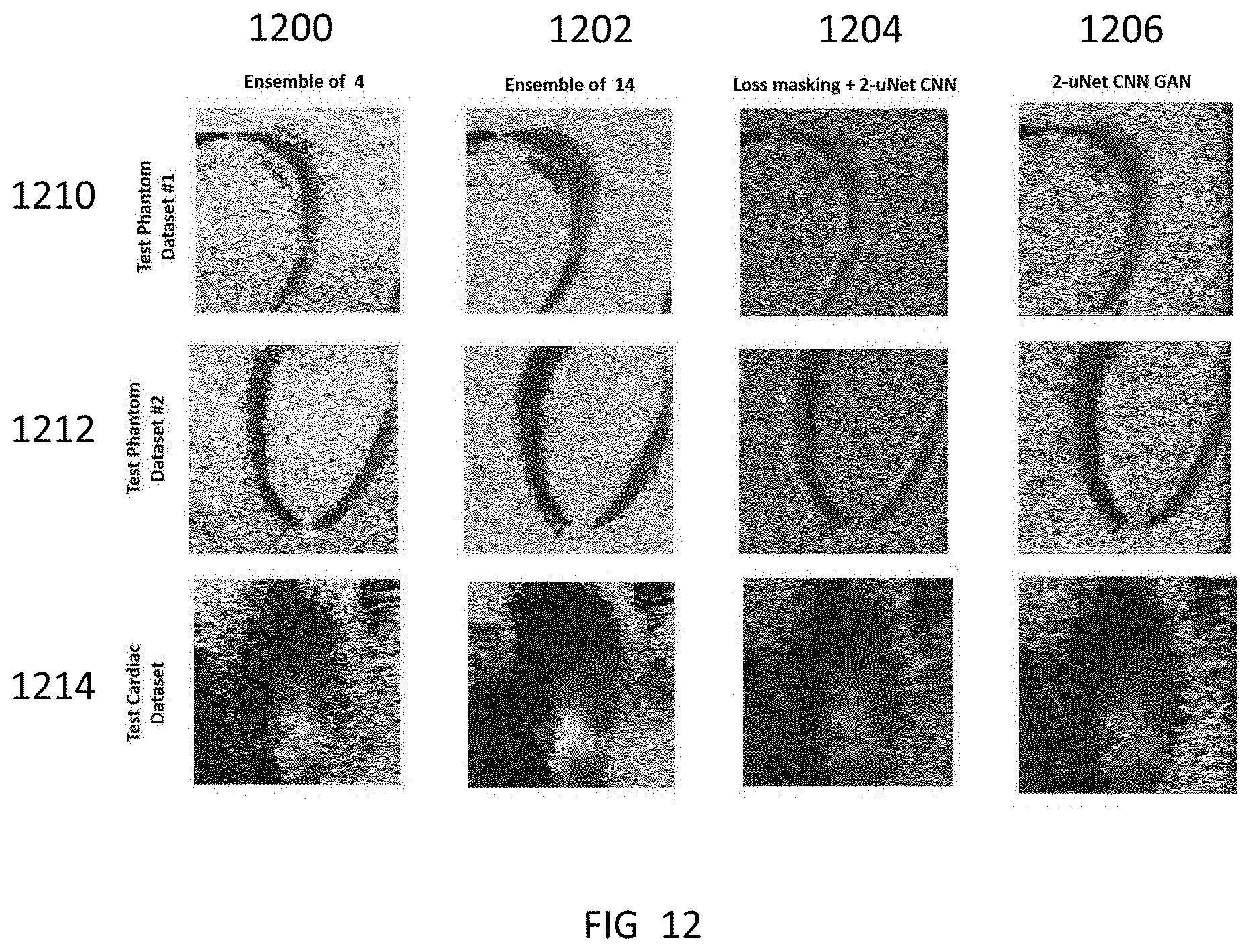 Patent US12422548 Figure 12 – Systems and methods for generating color doppler images from short and undersampled ensembles