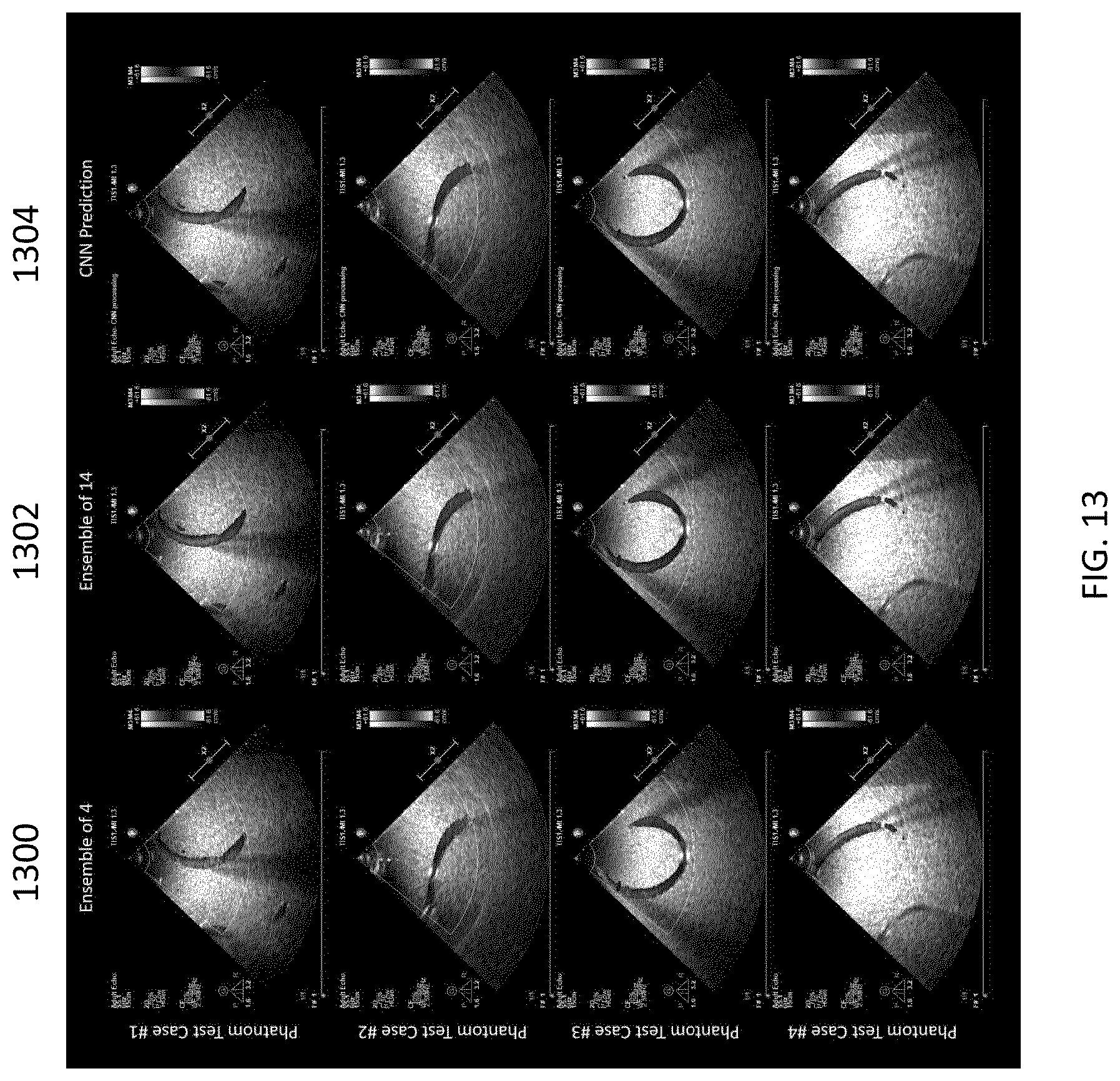 Patent US12422548 Figure 13 – Systems and methods for generating color doppler images from short and undersampled ensembles