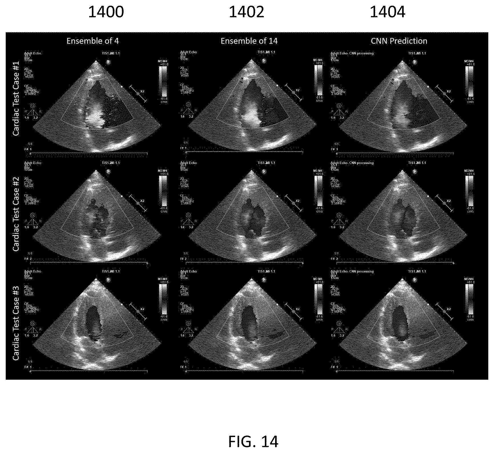 Patent US12422548 Figure 14 – Systems and methods for generating color doppler images from short and undersampled ensembles