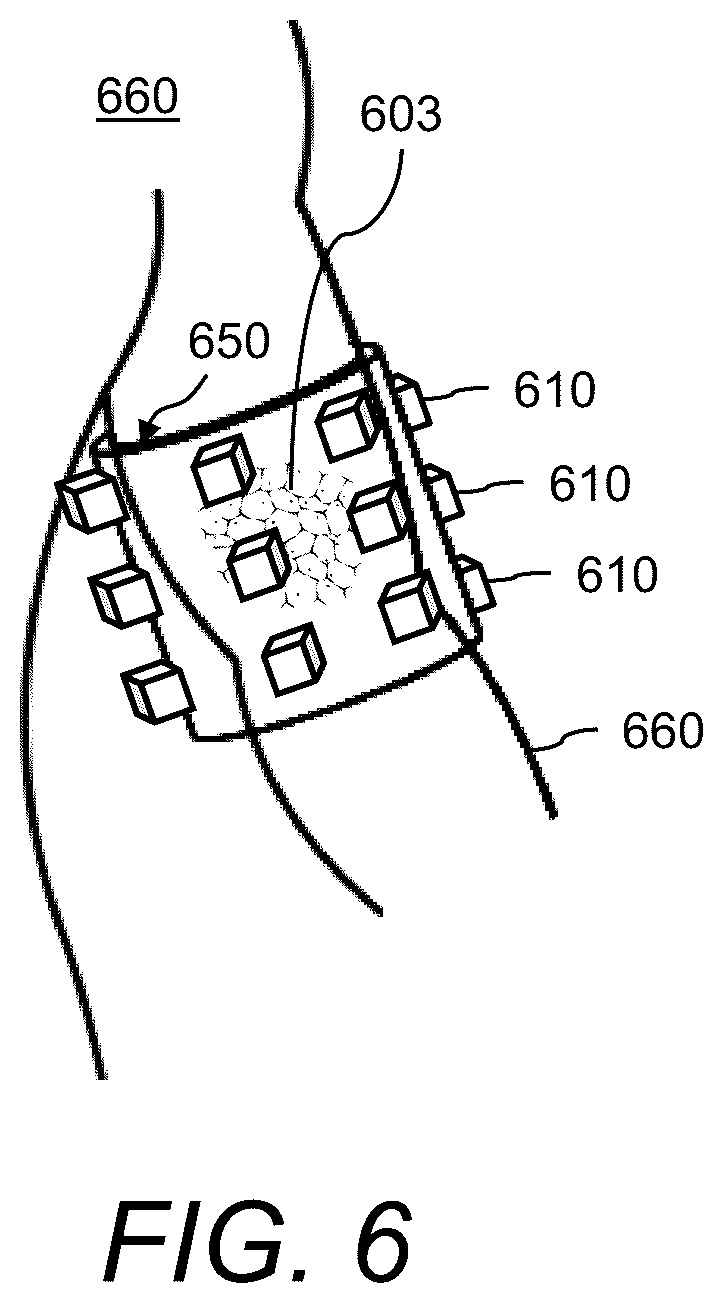 Patent US12422570 Figure 6 – System and methods for measuring patient-specific extravasation dosimetry