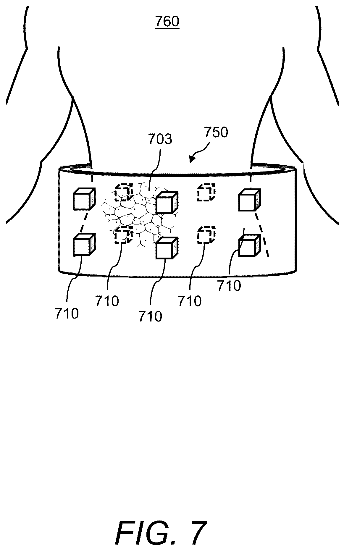 Patent US12422570 Figure 7 – System and methods for measuring patient-specific extravasation dosimetry