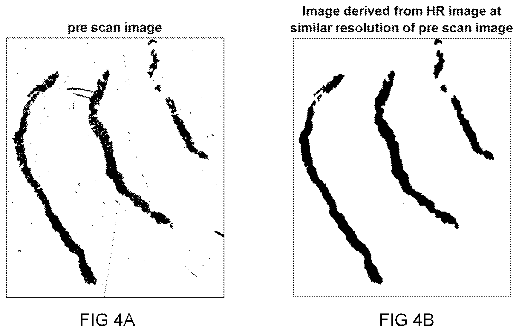 Patent US12422658 Figure 4 – Method for analysing scanning efficacy