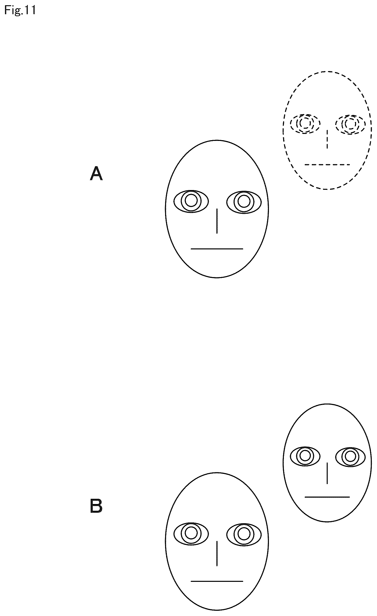 Patent US12422667 Figure 11 – Optical system, imaging apparatus, and projection apparatus