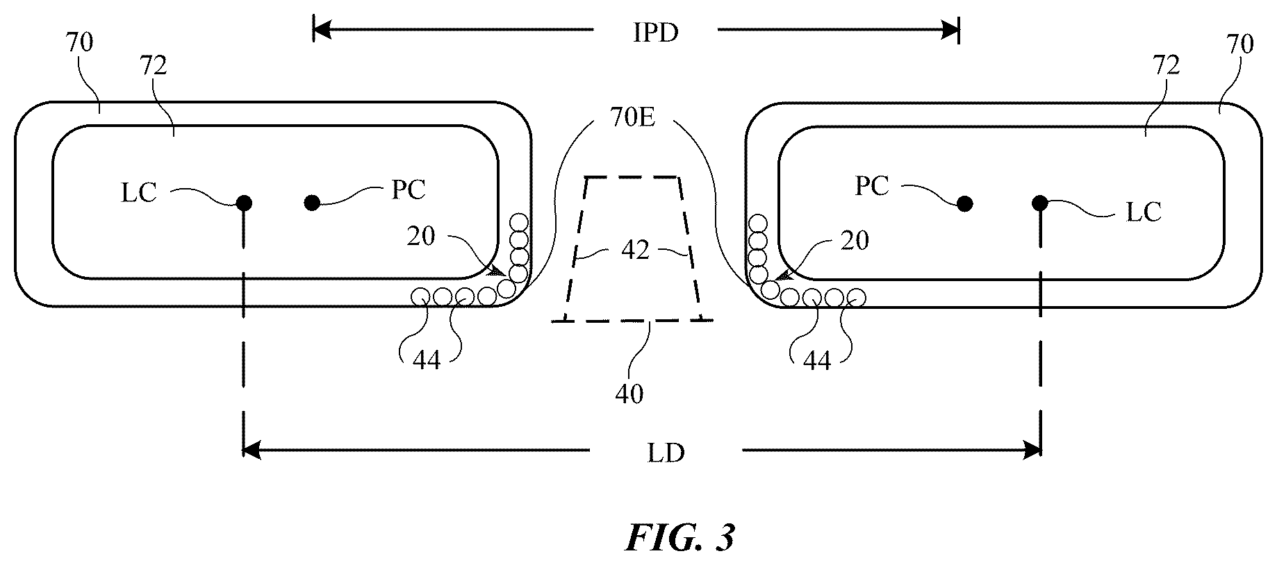 Patent US12422688 Figure 3 – Head-mounted electronic display device with lens position sensing