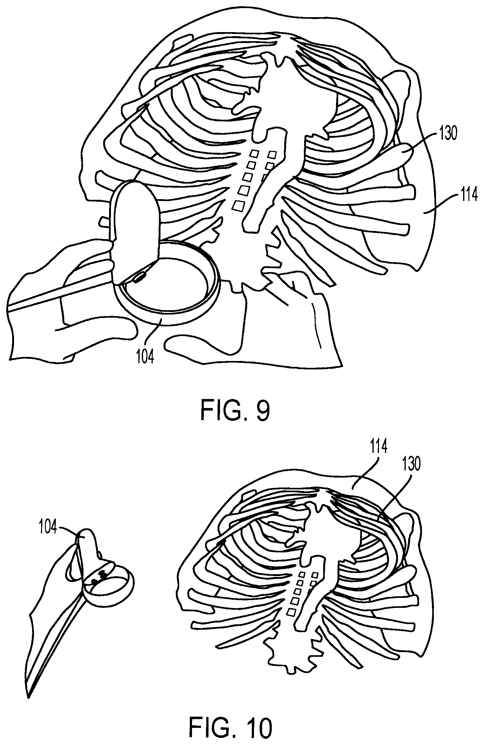 Patent US12422921 Figure 6 – Augmented reality point of view synchronisation system