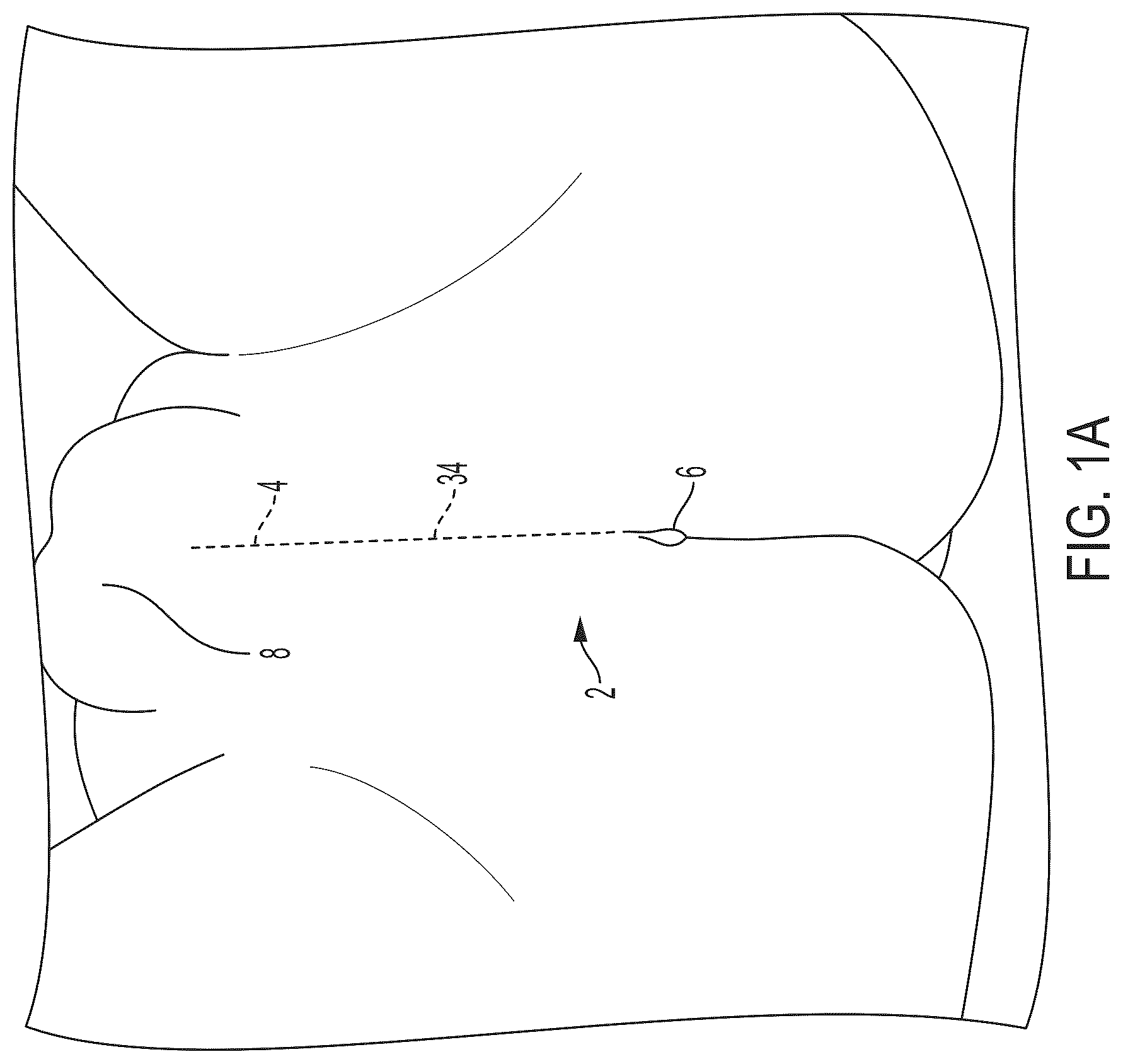 Patent US12426594 Figure 1 – Cryoprotective compositions and methods for protection of a surgical site during cryosurgery