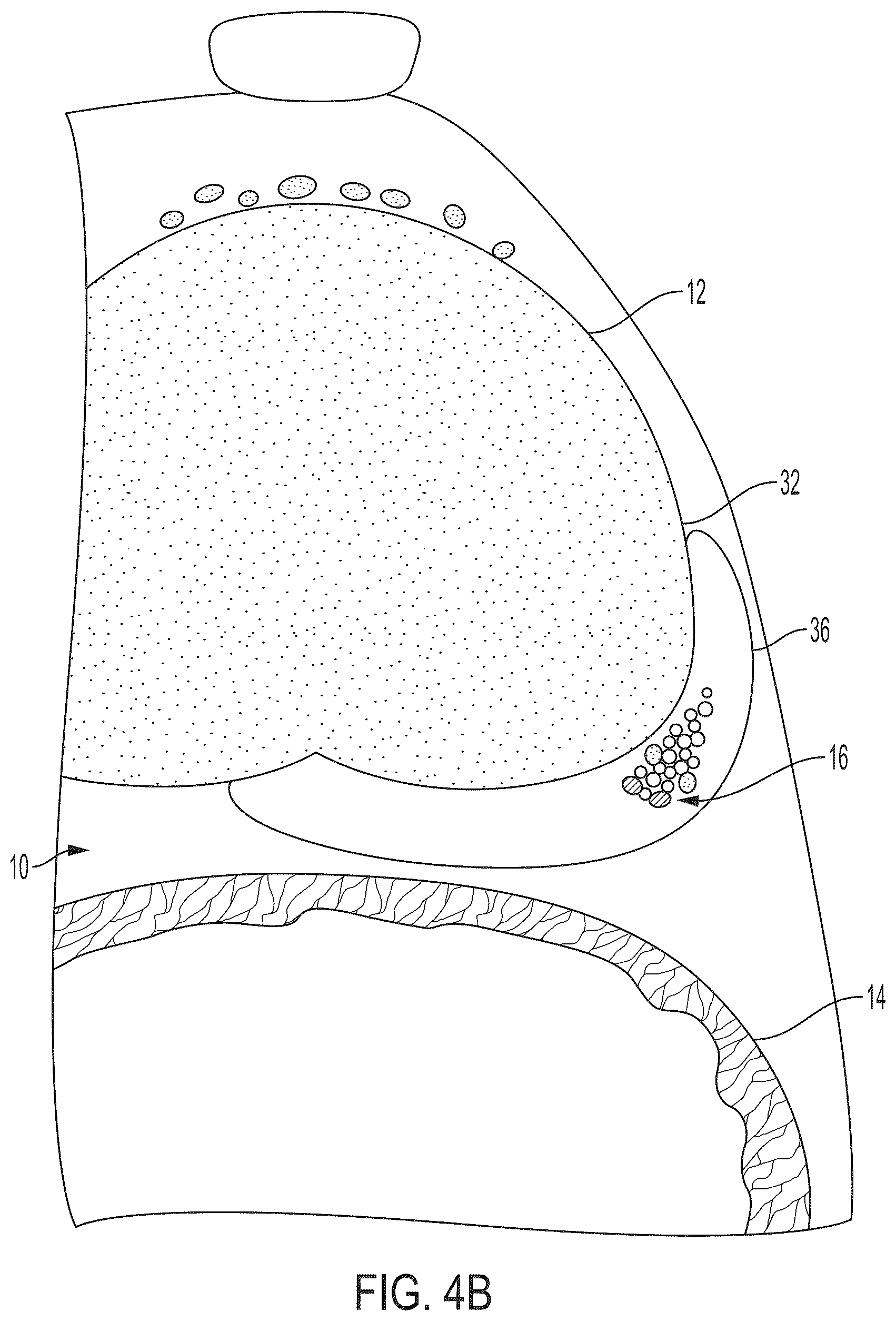 Patent US12426594 Figure 8 – Cryoprotective compositions and methods for protection of a surgical site during cryosurgery