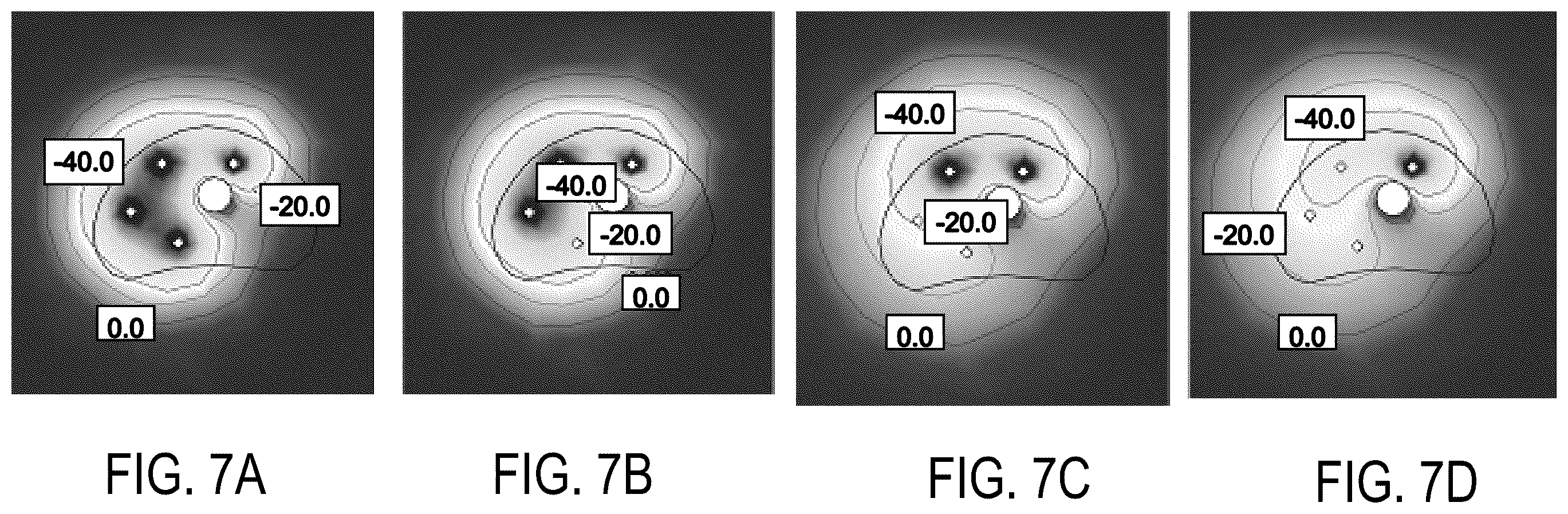 Patent US12426594 Figure 11 – Cryoprotective compositions and methods for protection of a surgical site during cryosurgery