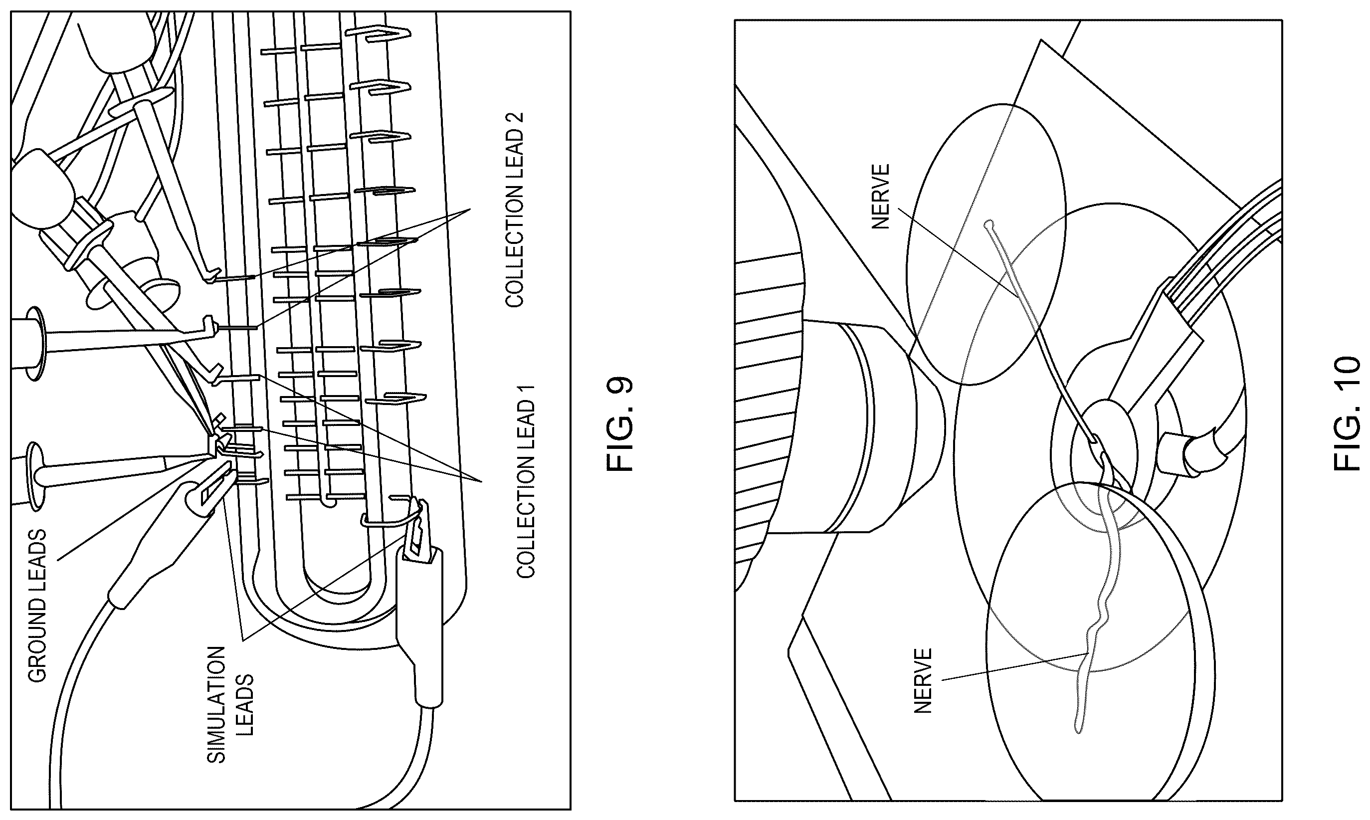 Patent US12426594 Figure 14 – Cryoprotective compositions and methods for protection of a surgical site during cryosurgery