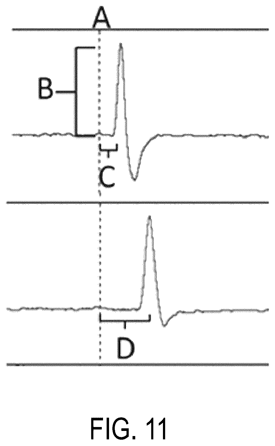 Patent US12426594 Figure 15 – Cryoprotective compositions and methods for protection of a surgical site during cryosurgery