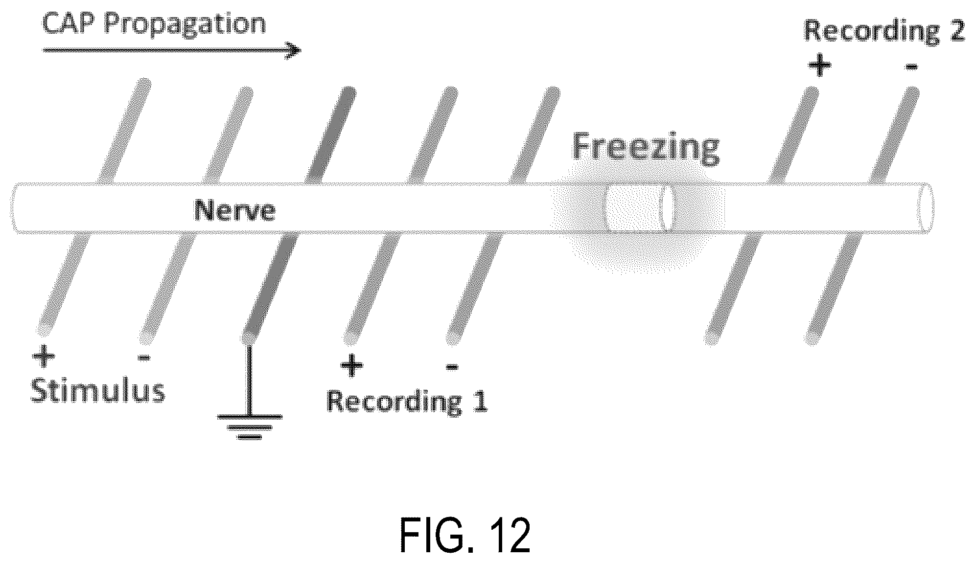 Patent US12426594 Figure 16 – Cryoprotective compositions and methods for protection of a surgical site during cryosurgery