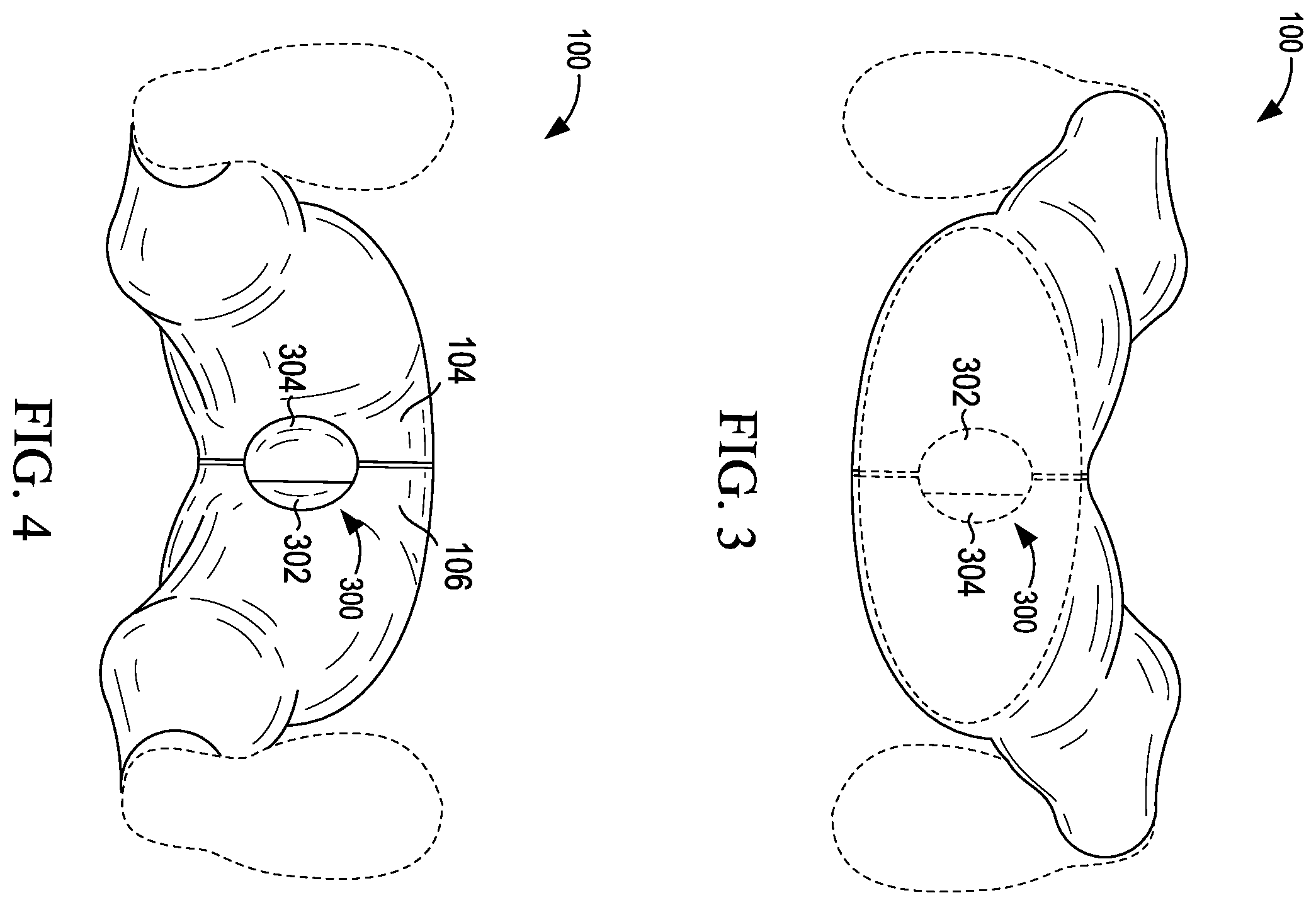 Patent US12426648 Figure 3 – Garment having a manipulable crotch area