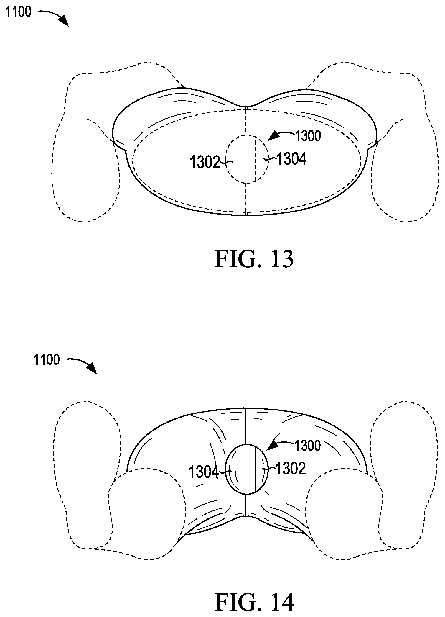Patent US12426648 Figure 11 – Garment having a manipulable crotch area