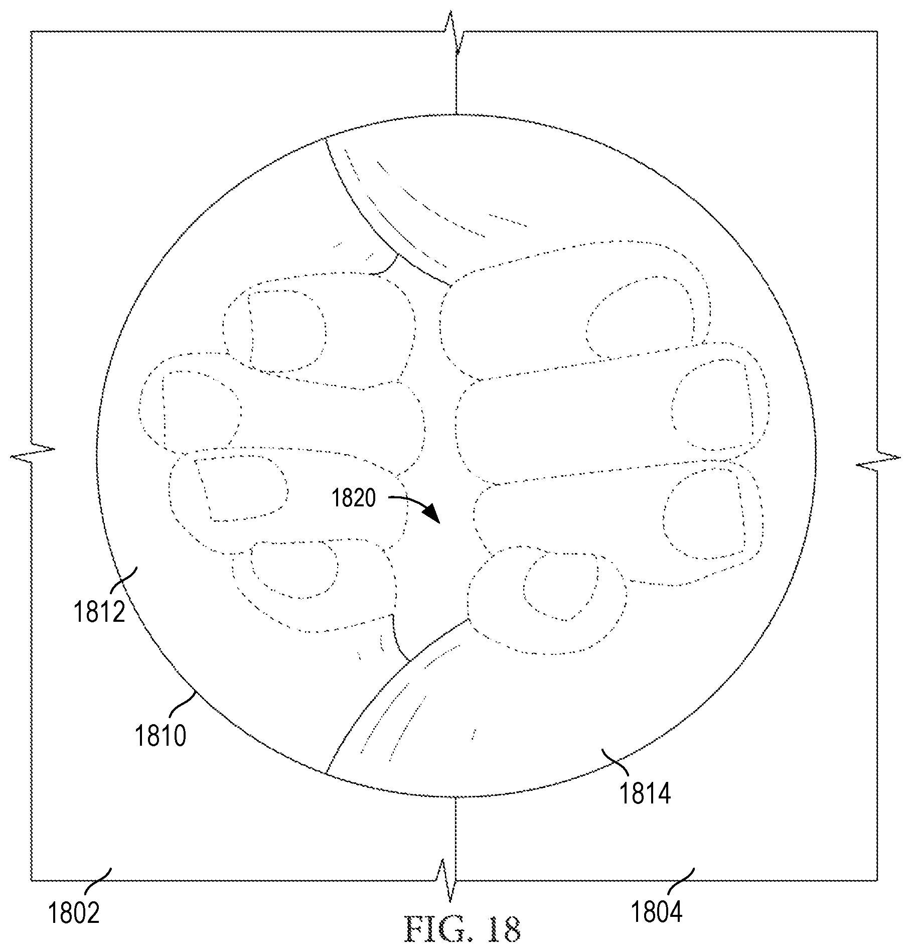 Patent US12426648 Figure 15 – Garment having a manipulable crotch area