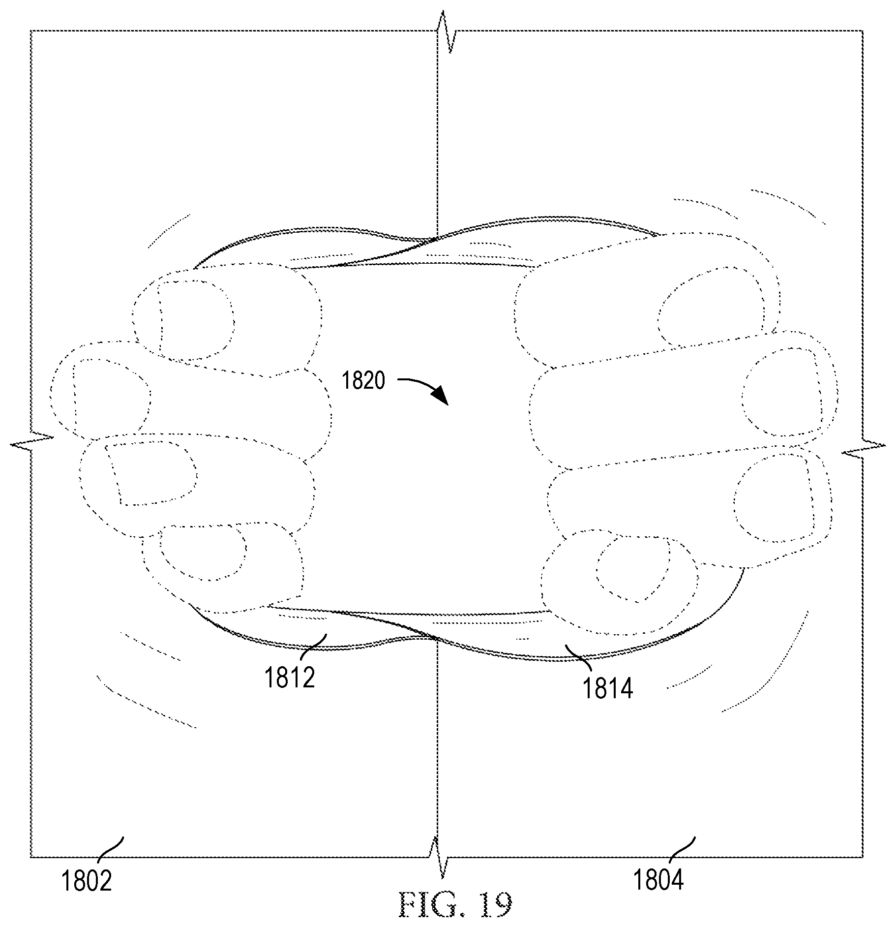 Patent US12426648 Figure 16 – Garment having a manipulable crotch area