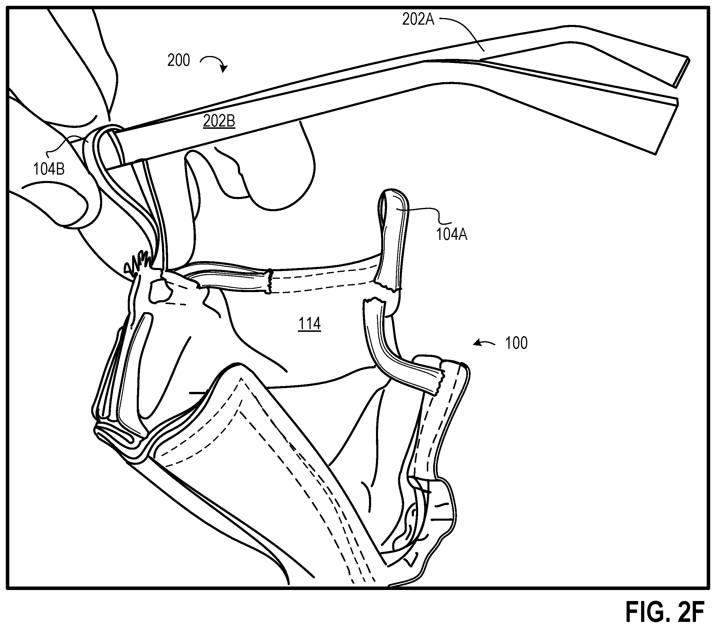 Patent US12426651 Figure 9 – Eyewear facemask