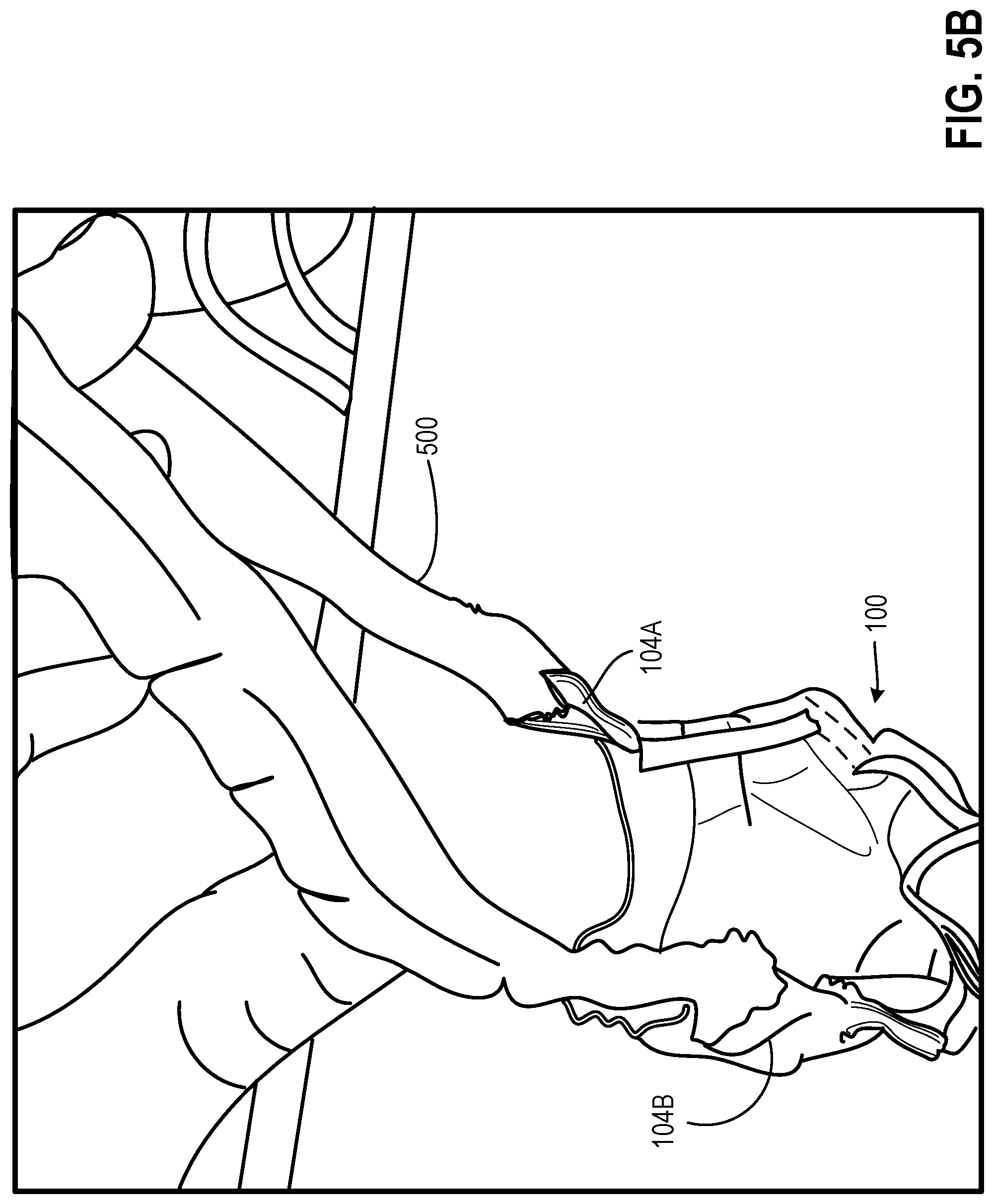 Patent US12426651 Figure 15 – Eyewear facemask