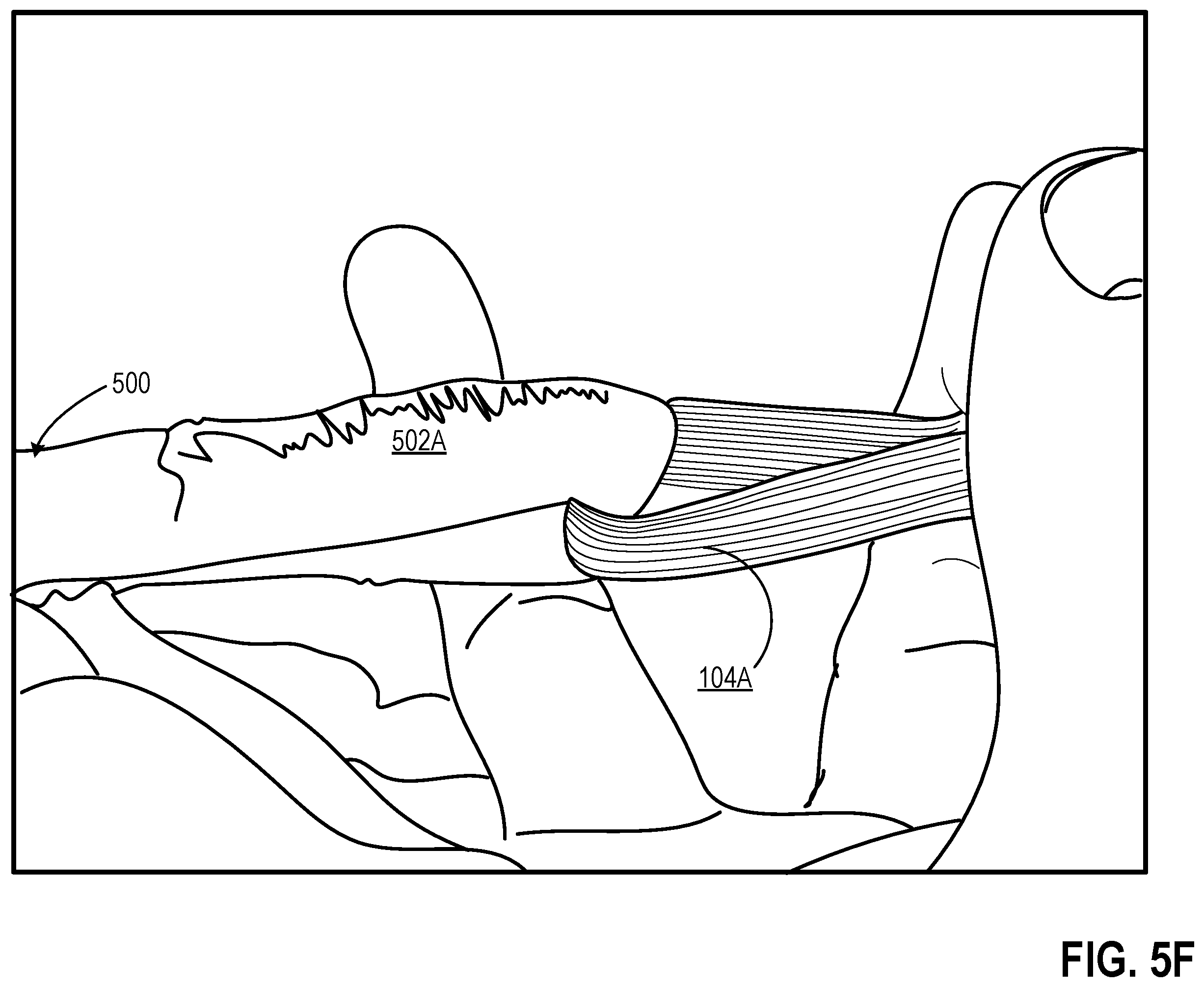 Patent US12426651 Figure 19 – Eyewear facemask