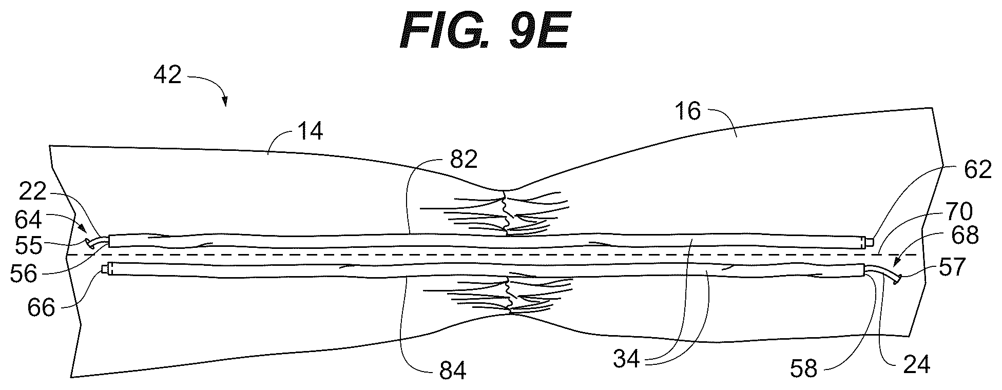 Patent US12426653 Figure 13 – Pre-configured scarf with built-in closure