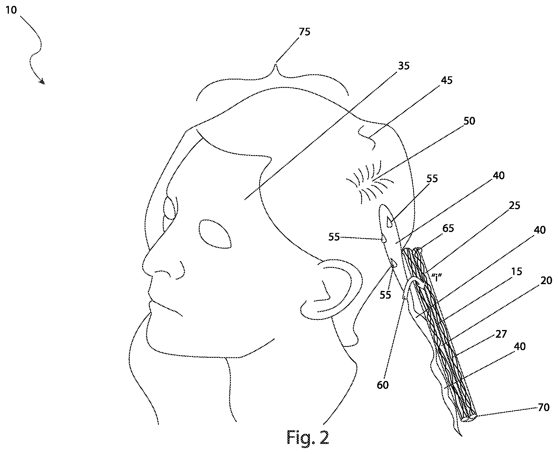 Patent US12426654 Figure 2 – Hair strand styling device