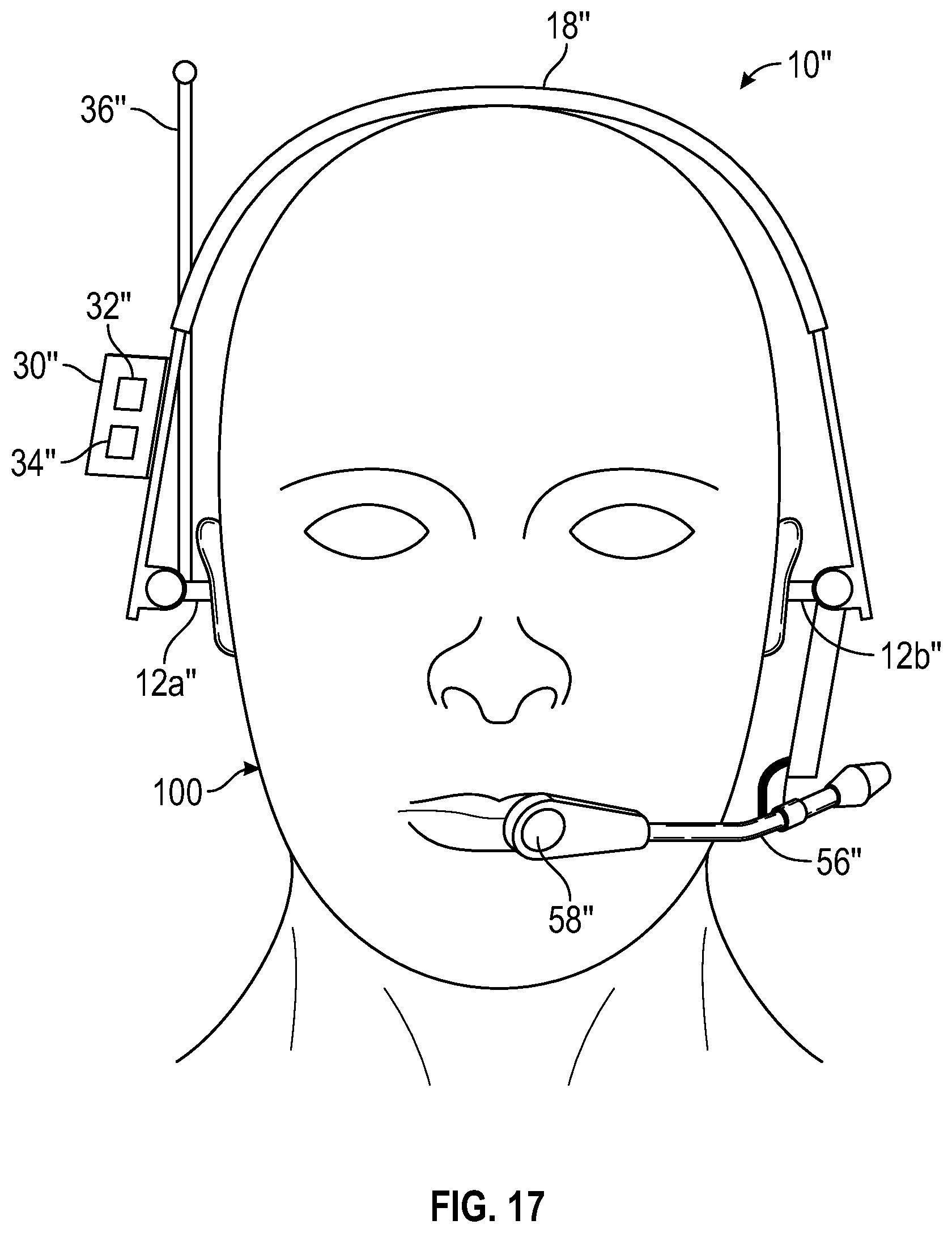 Patent US12426656 Figure 11 – Hearing protection device, collision warning system and method of retrofitting a hearing protection device with a detection unit