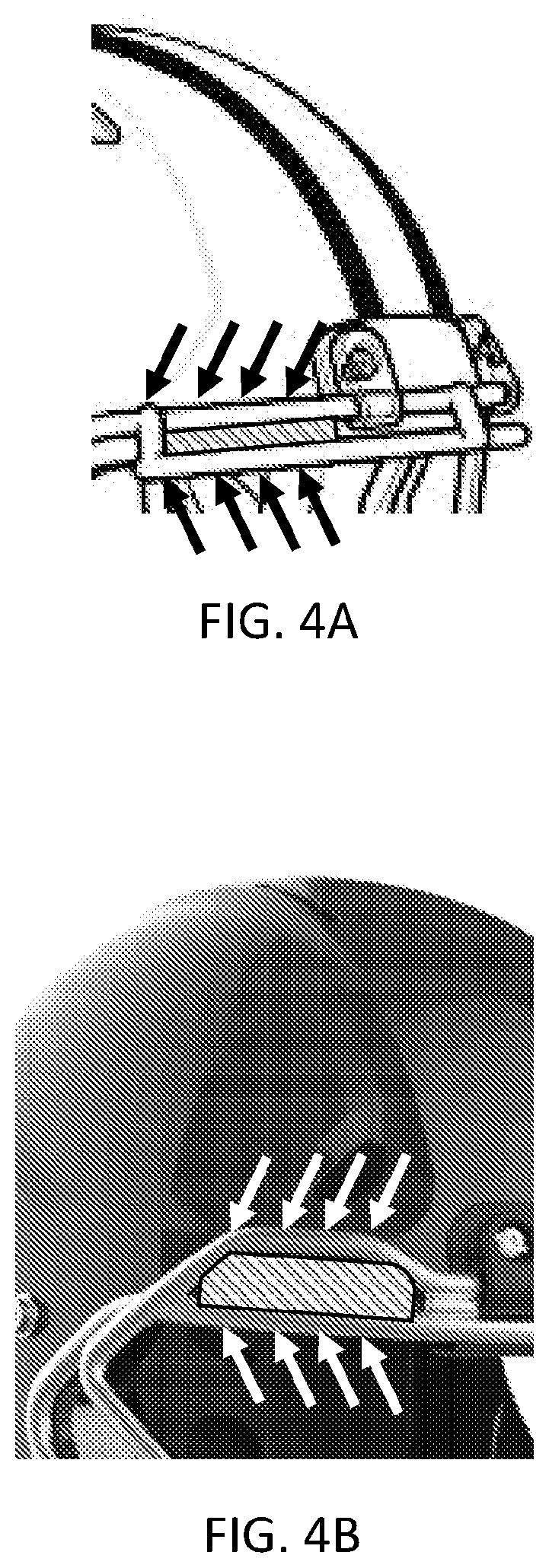Patent US12426662 Figure 3 – Facemask system