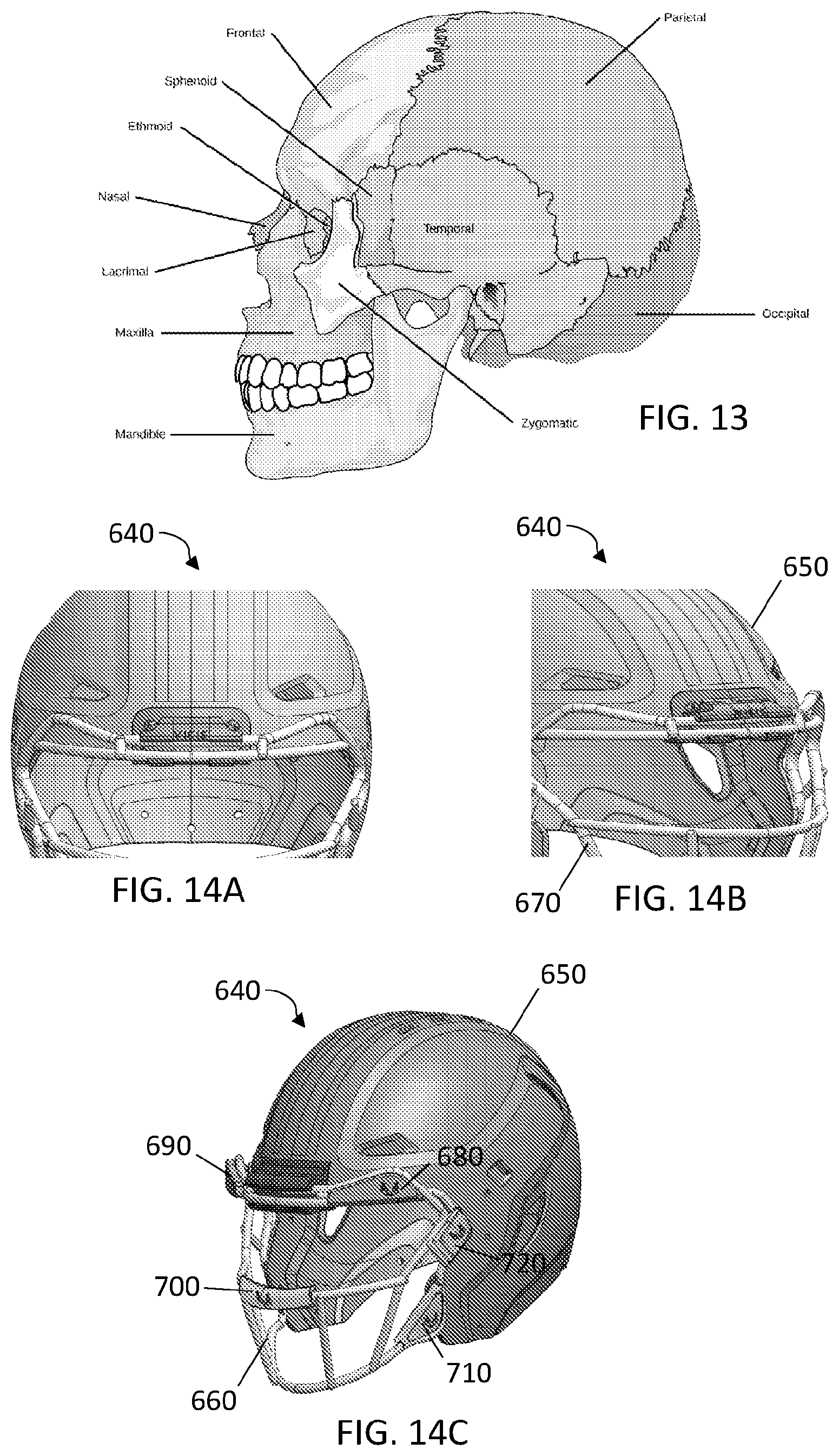 Patent US12426662 Figure 14 – Facemask system