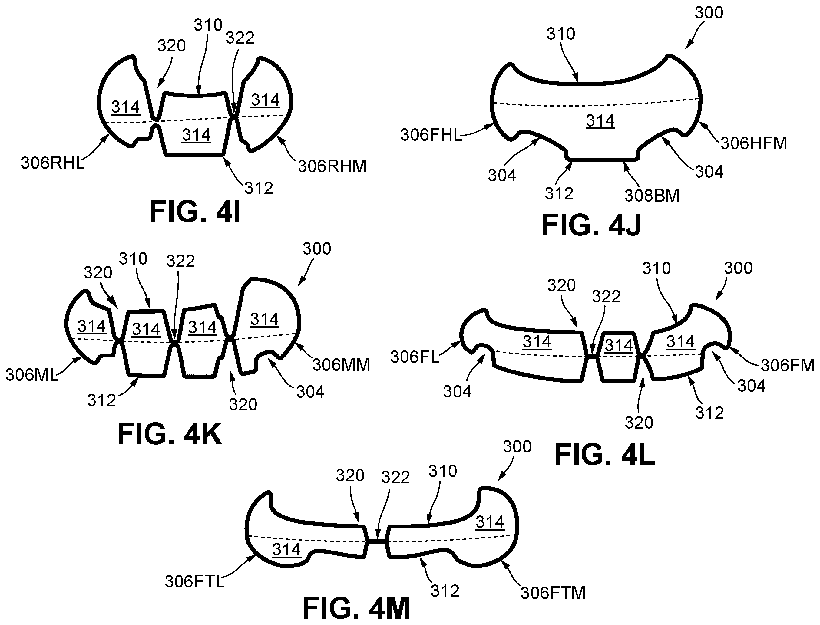 Patent US12426664 Figure 10 – Articles of footwear having modular, replaceable, and/or recyclable parts