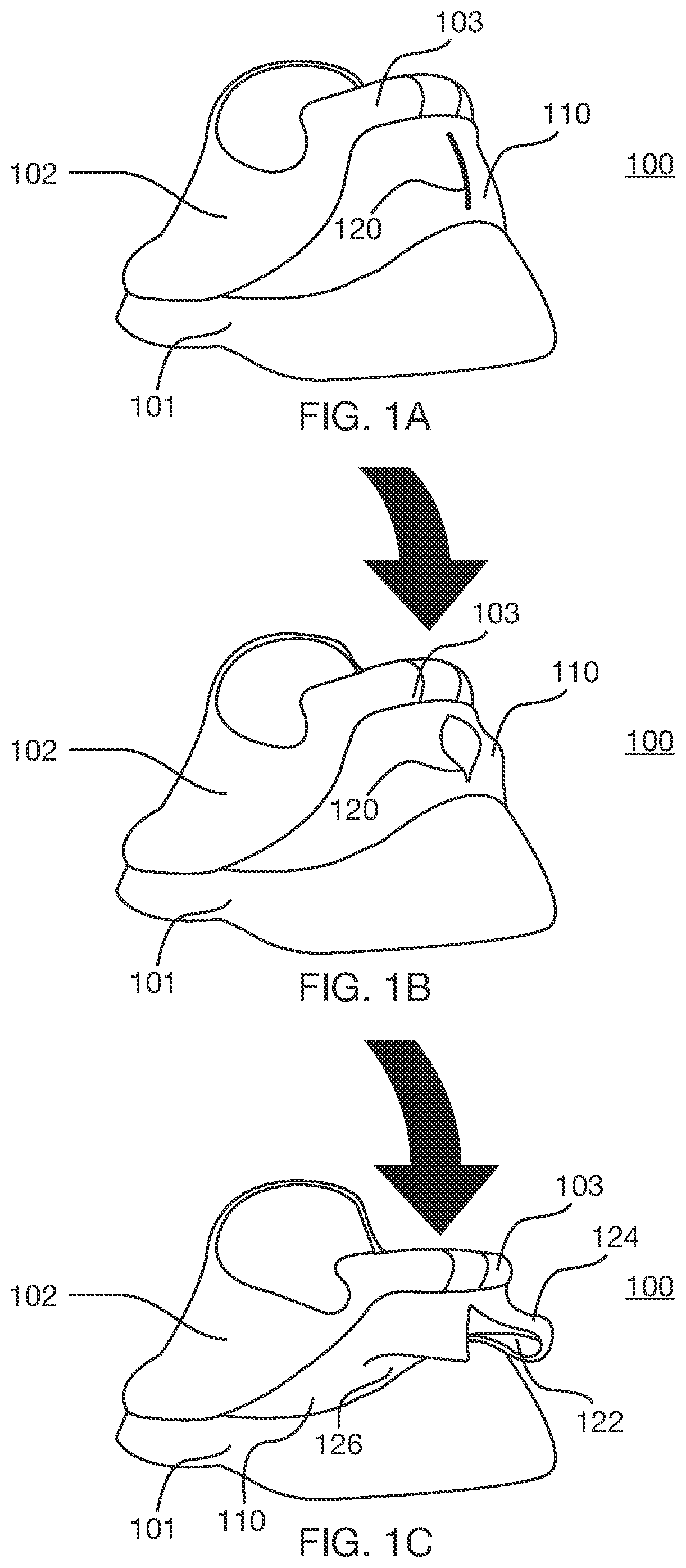 Patent US12426666 Figure 1 – Rapid-entry footwear having a split back