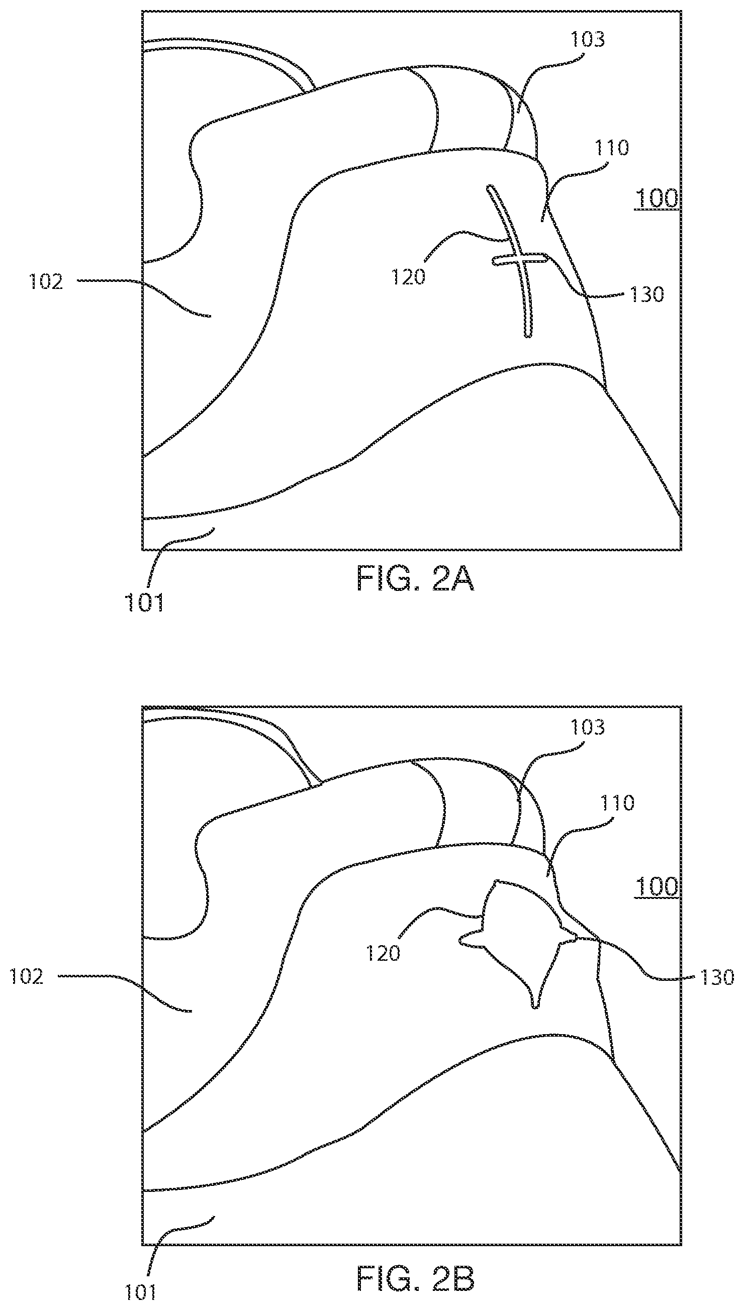 Patent US12426666 Figure 2 – Rapid-entry footwear having a split back