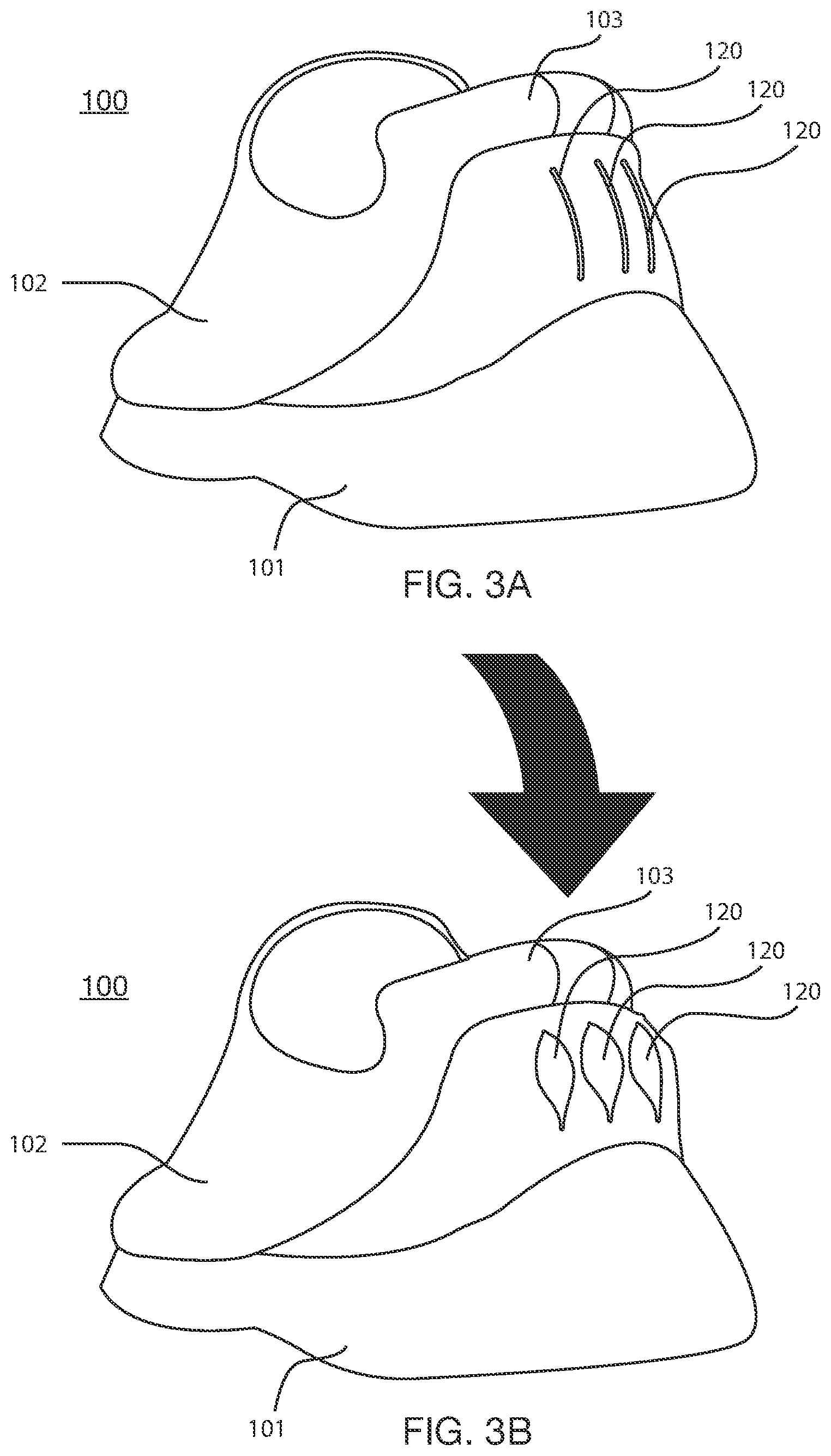 Patent US12426666 Figure 3 – Rapid-entry footwear having a split back