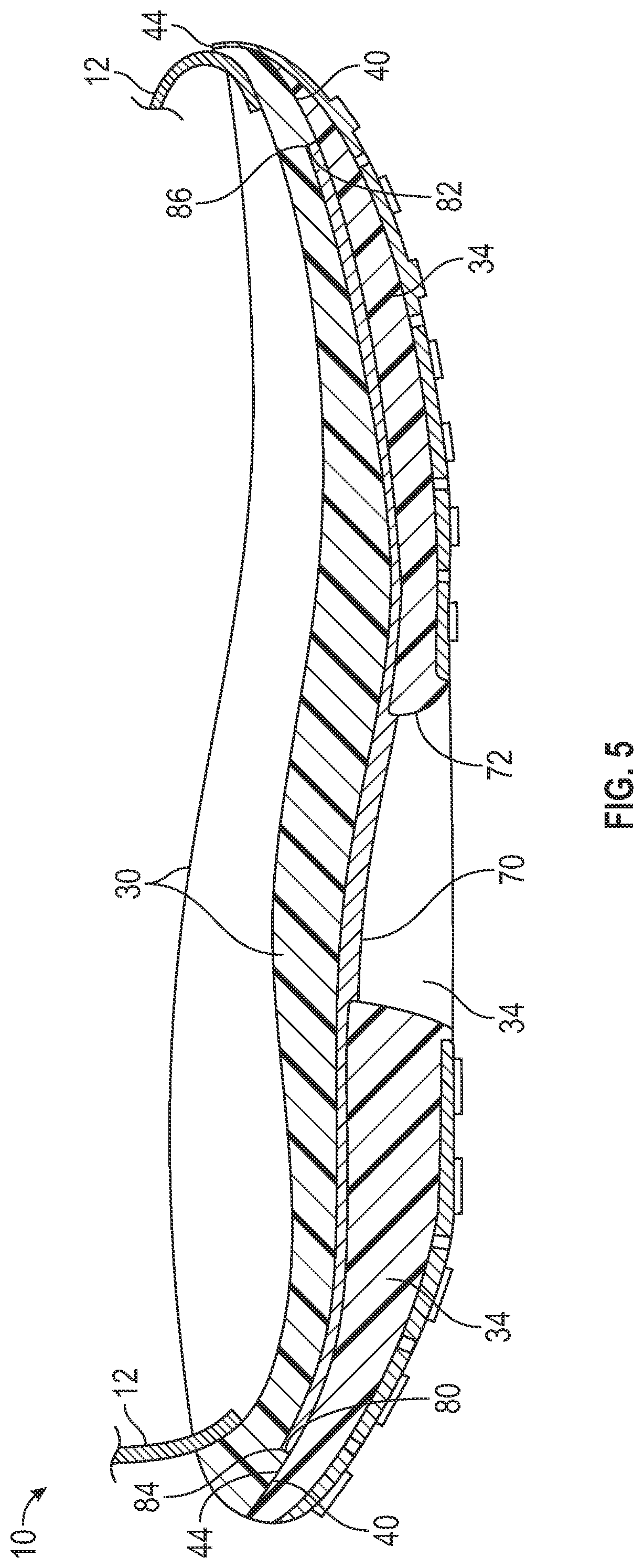 Patent US12426669 Figure 4 – Article of footwear having a sole structure with a plate for stability