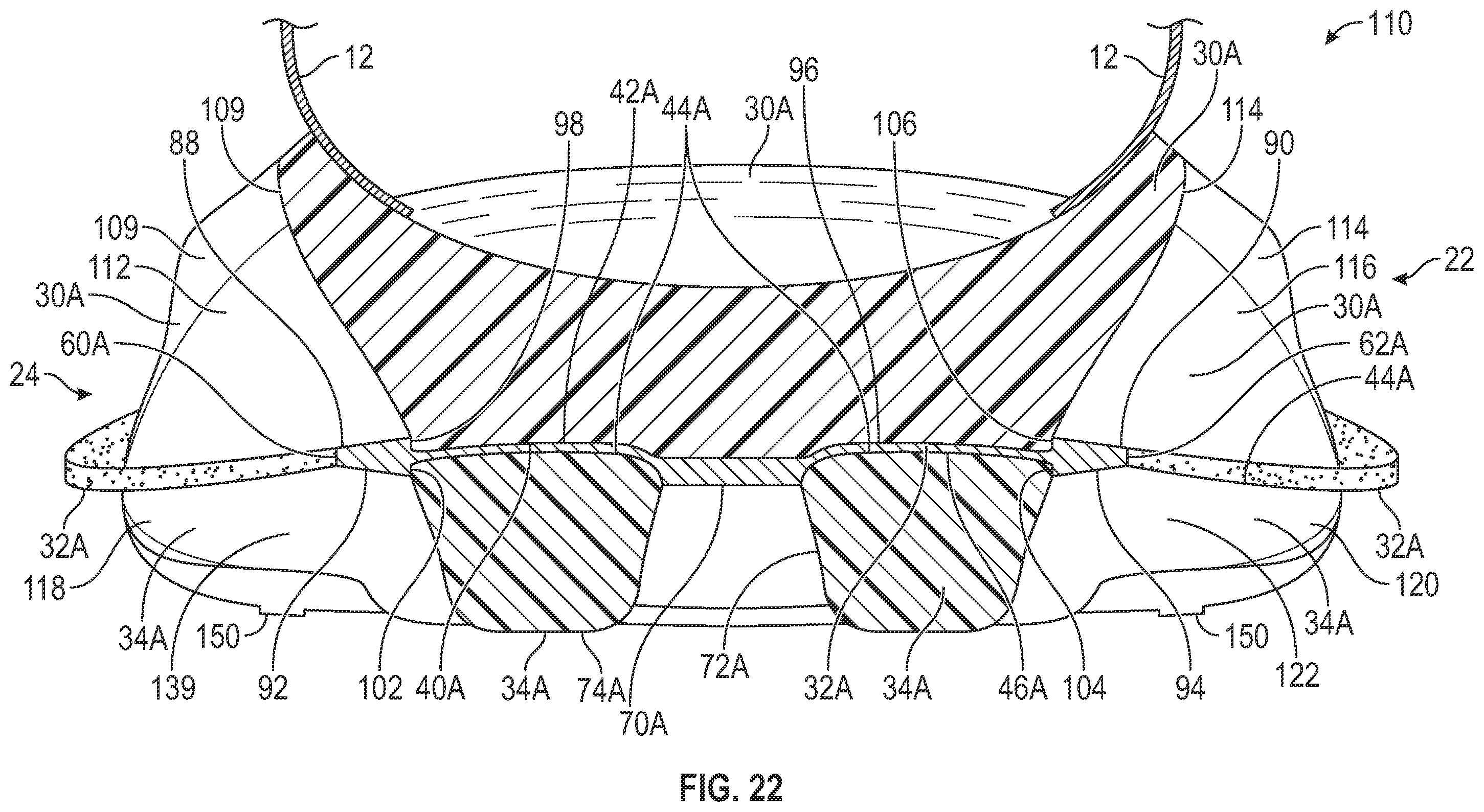 Patent US12426669 Figure 15 – Article of footwear having a sole structure with a plate for stability