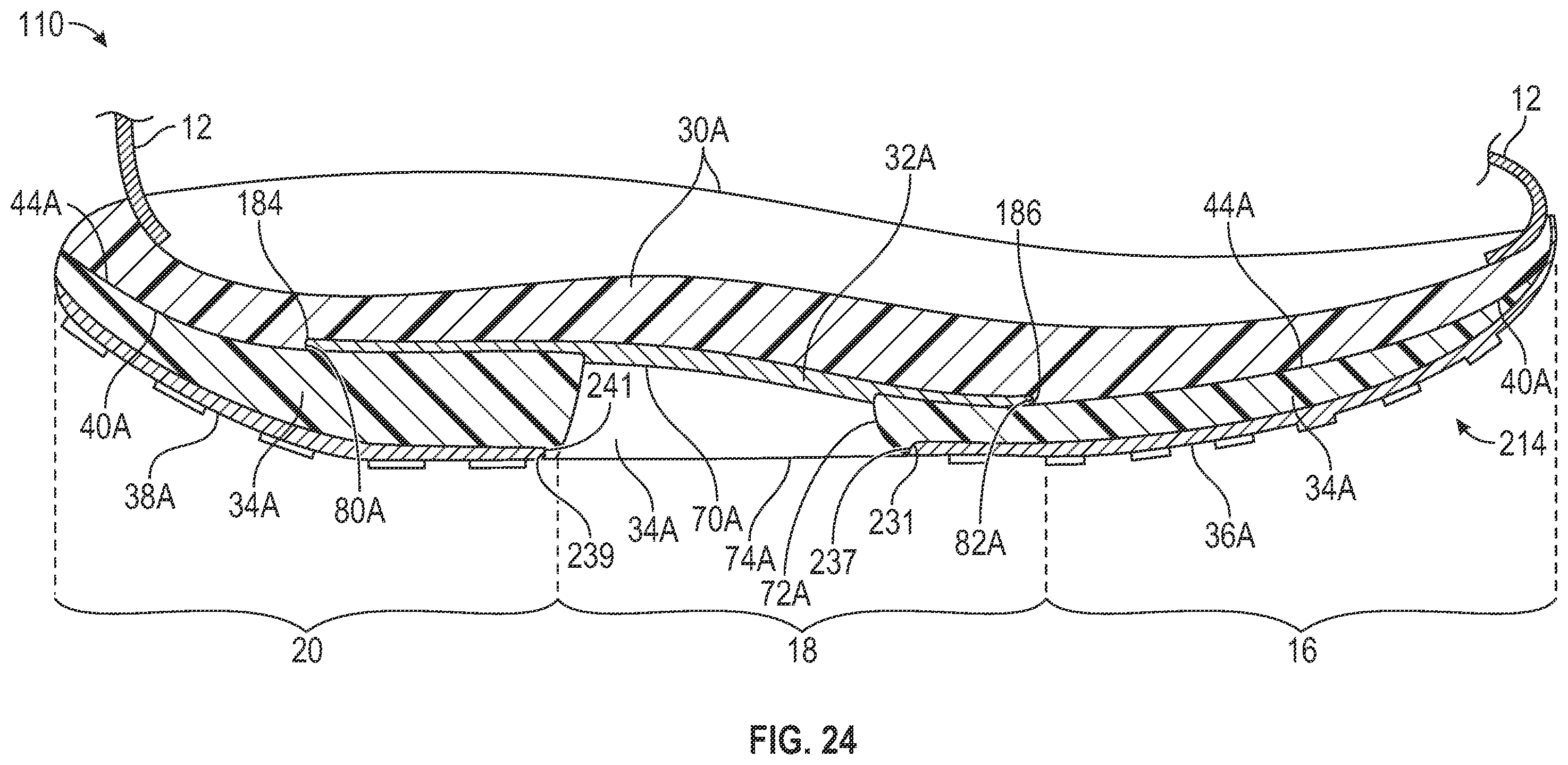 Patent US12426669 Figure 17 – Article of footwear having a sole structure with a plate for stability