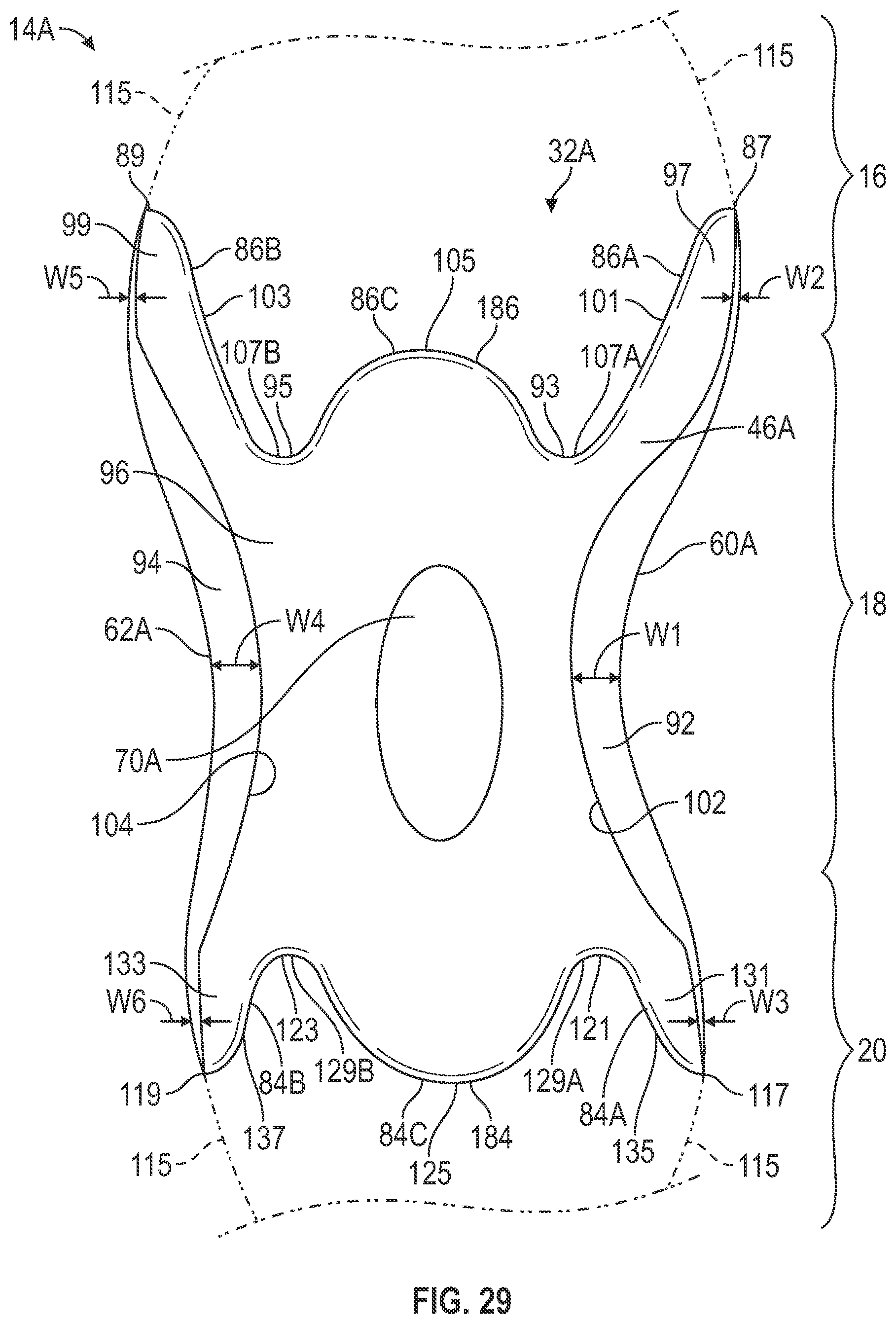 Patent US12426669 Figure 20 – Article of footwear having a sole structure with a plate for stability