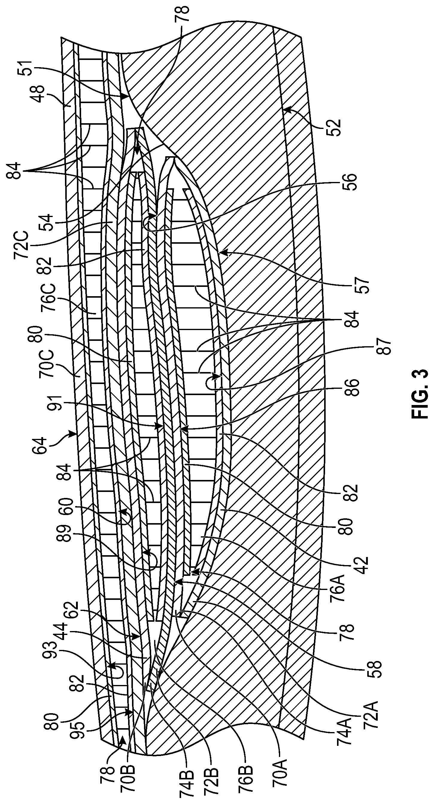 Patent US12426679 Figure 3 – Article of footwear with stacked forefoot bladders