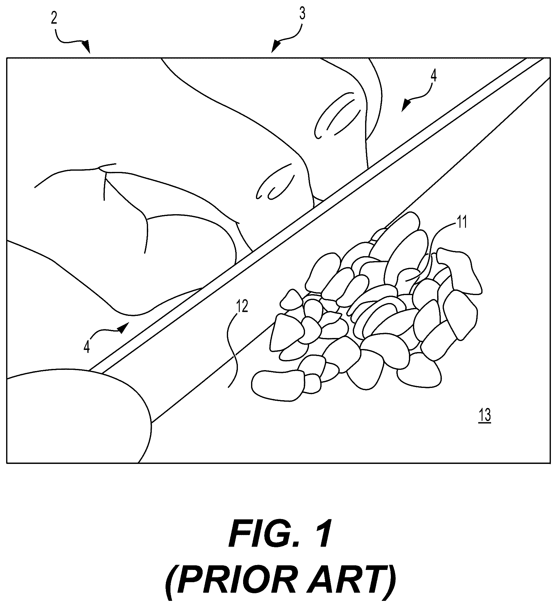 Patent US12426742 Figure 1 – Hand-held multi-purpose kitchen tool