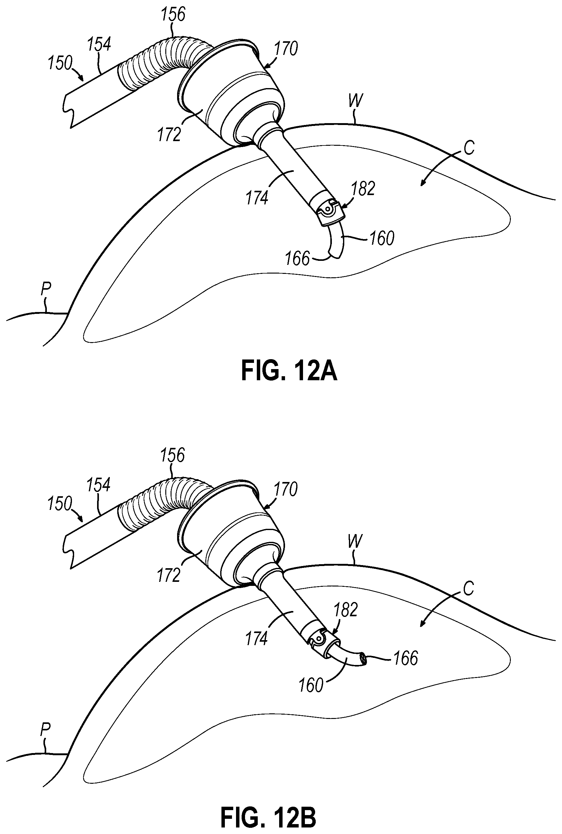 Patent US12426772 Figure 8 – Articulating introducer cannula for surgical scope in robotic system