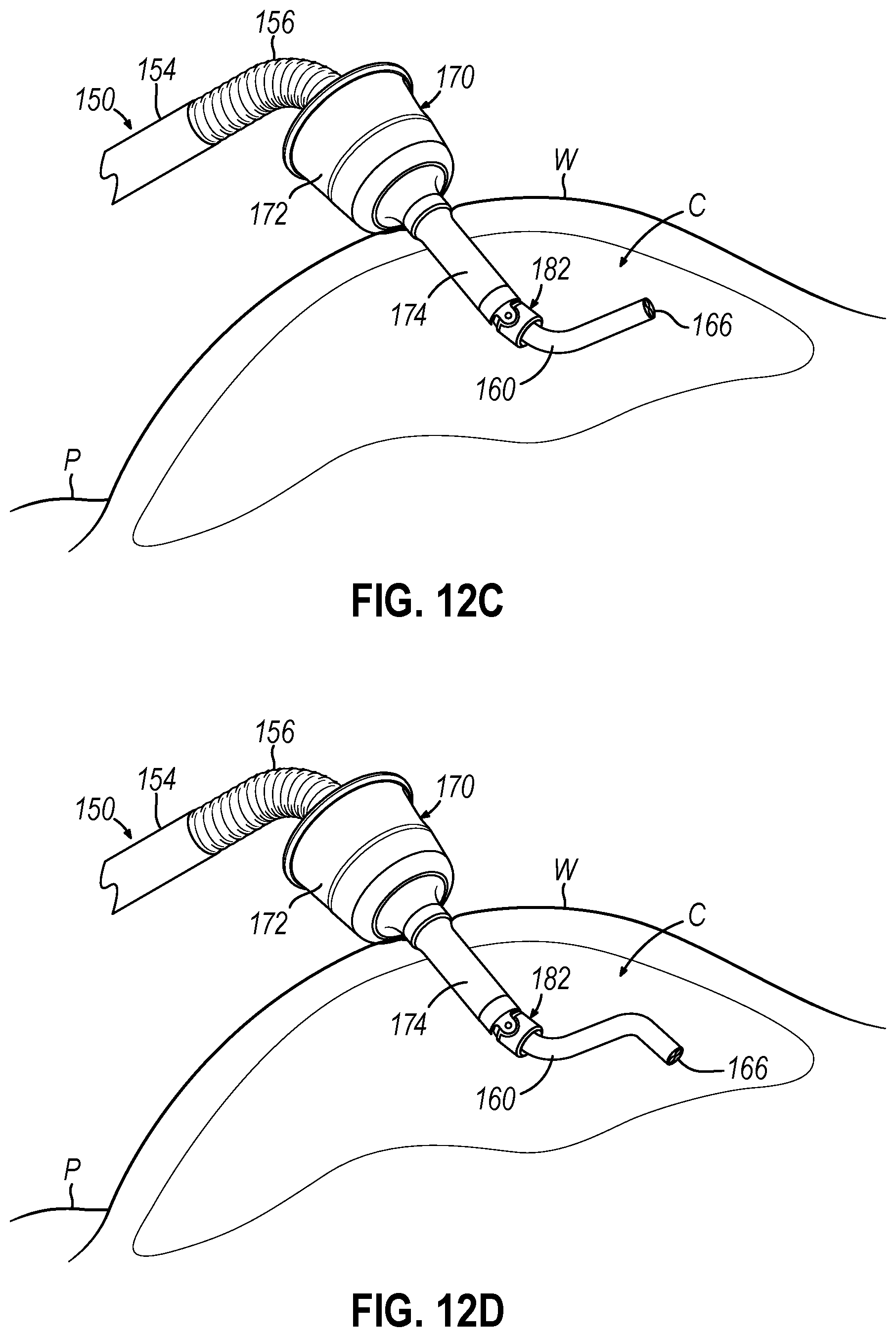 Patent US12426772 Figure 9 – Articulating introducer cannula for surgical scope in robotic system