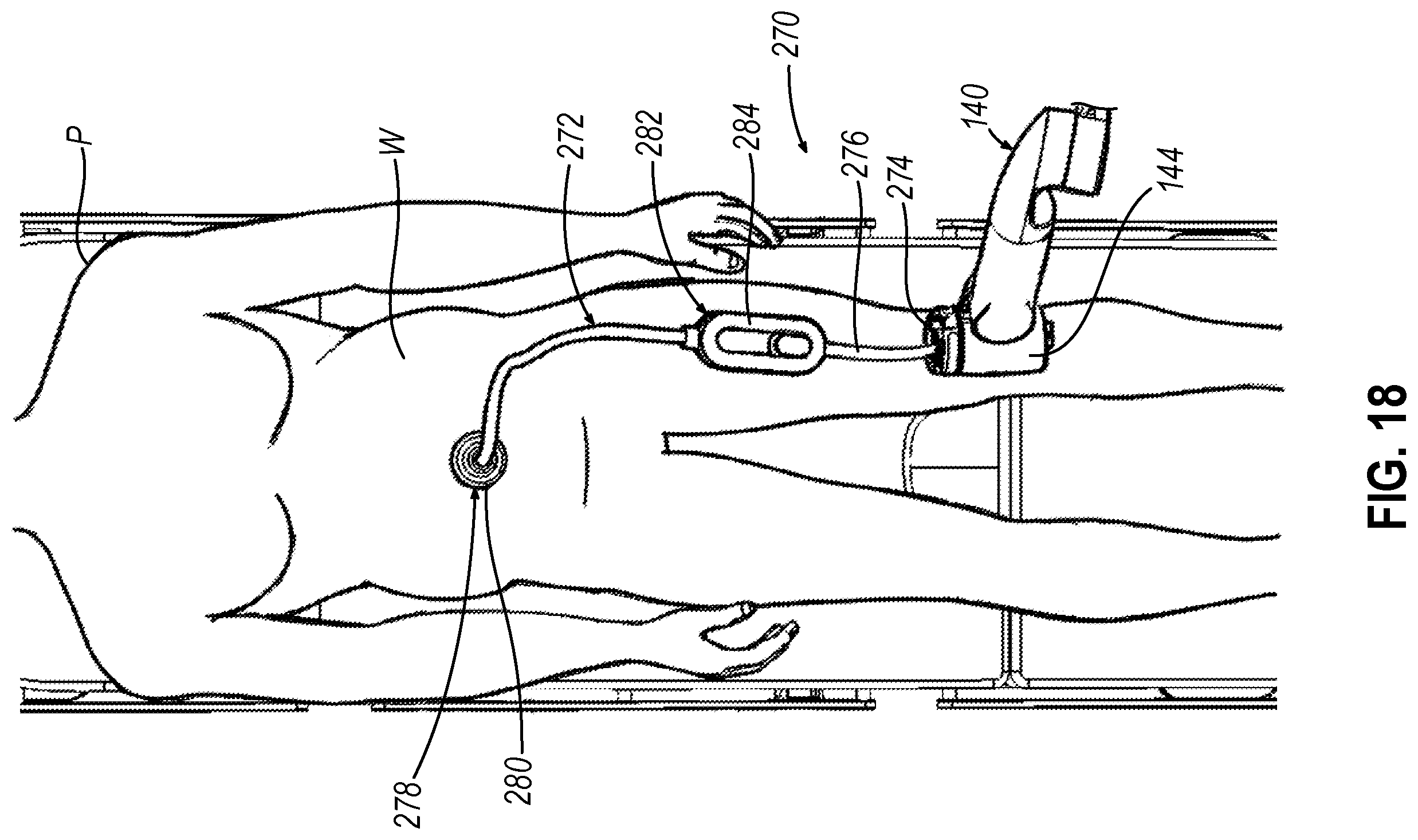 Patent US12426772 Figure 17 – Articulating introducer cannula for surgical scope in robotic system