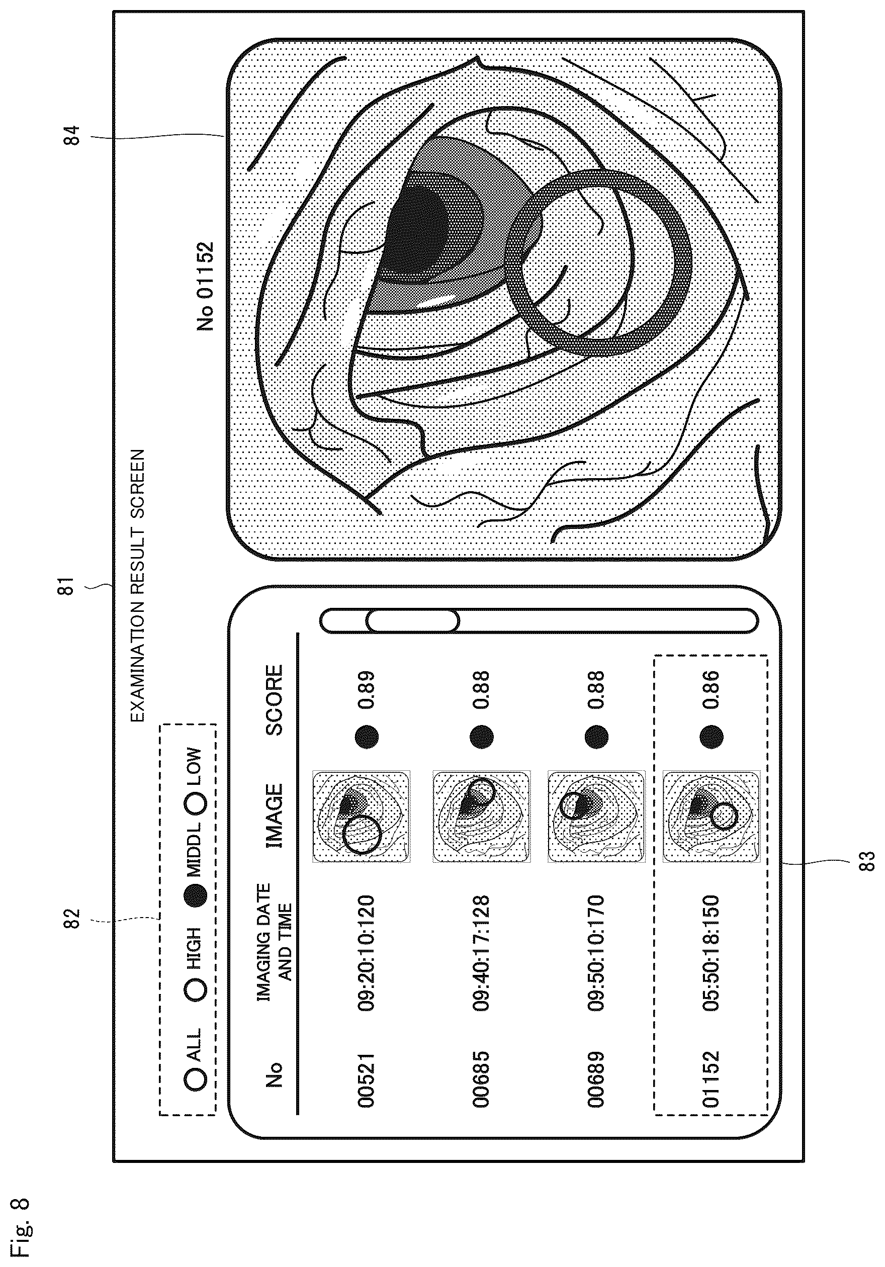 Patent US12426774 Figure 8 – Endoscopy support apparatus, endoscopy support method, and computer readable recording medium