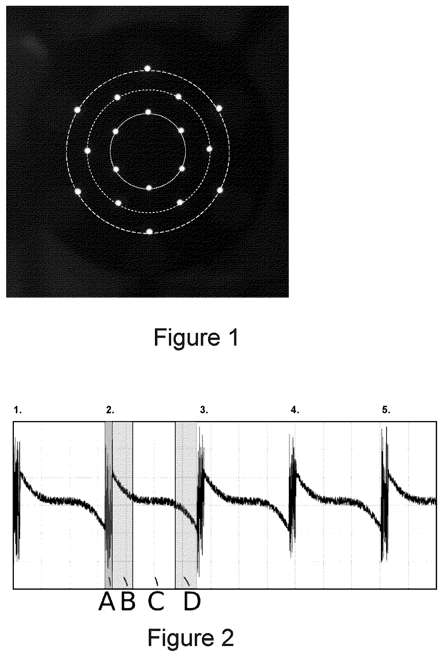 Patent US12426778 Figure 1 – Method for ascertaining physiologically correct biometric data of an eye